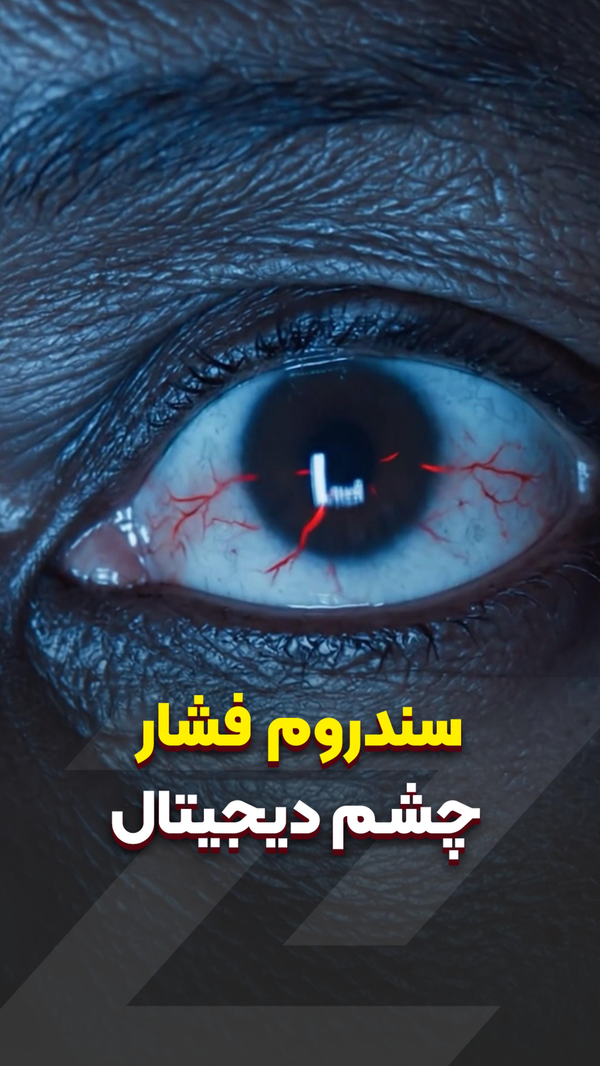 سندرم فشار چشم دیجیتال