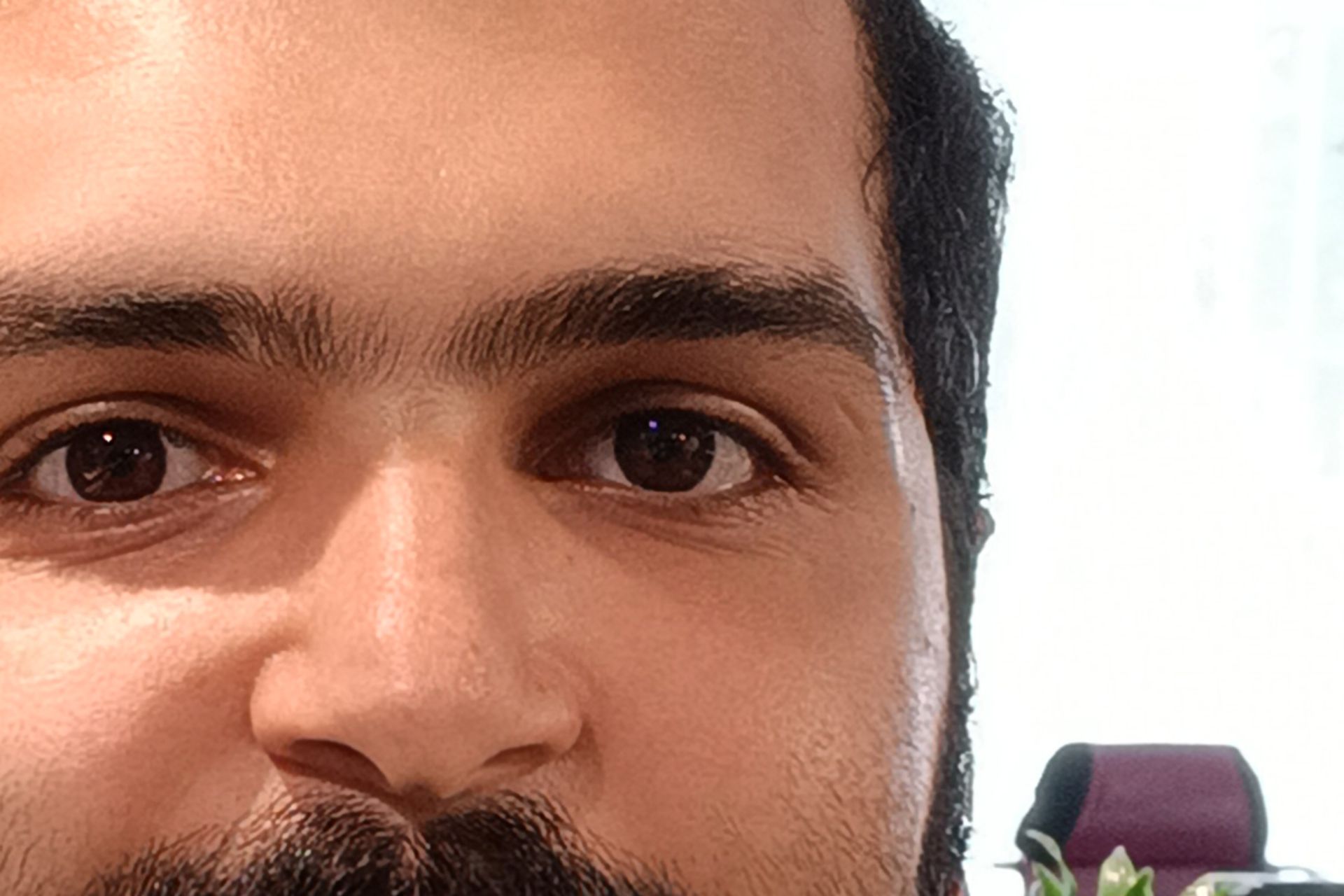 برش دوربین سلفی ردمی نوت 11S