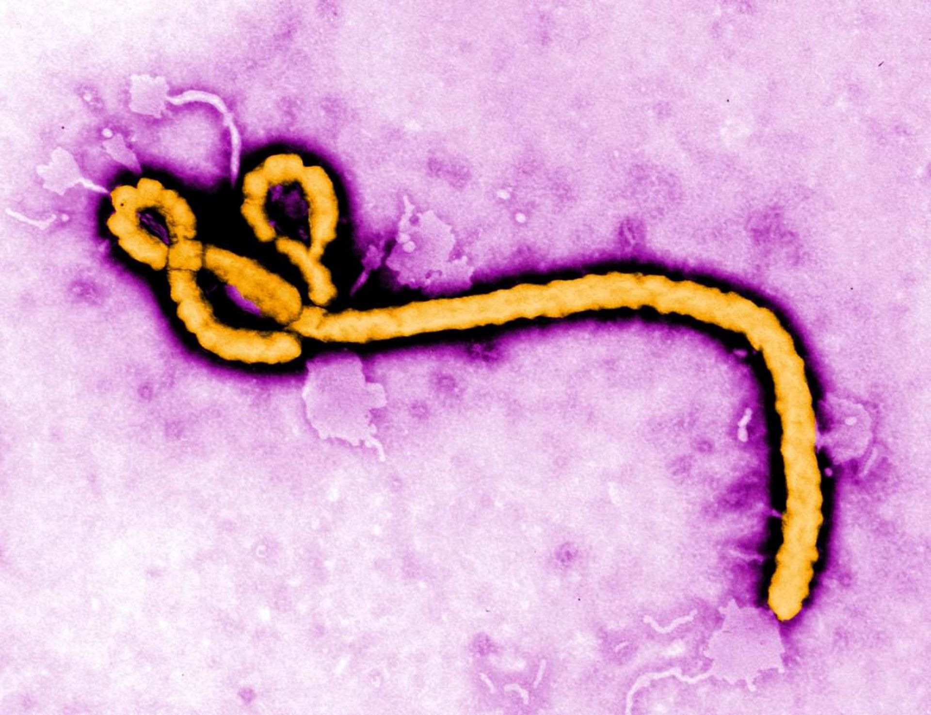 virus