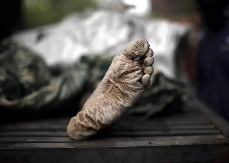 dead-body