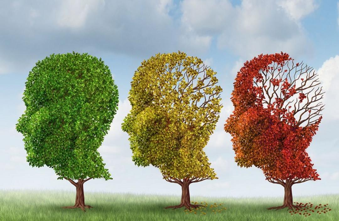 alzheimer