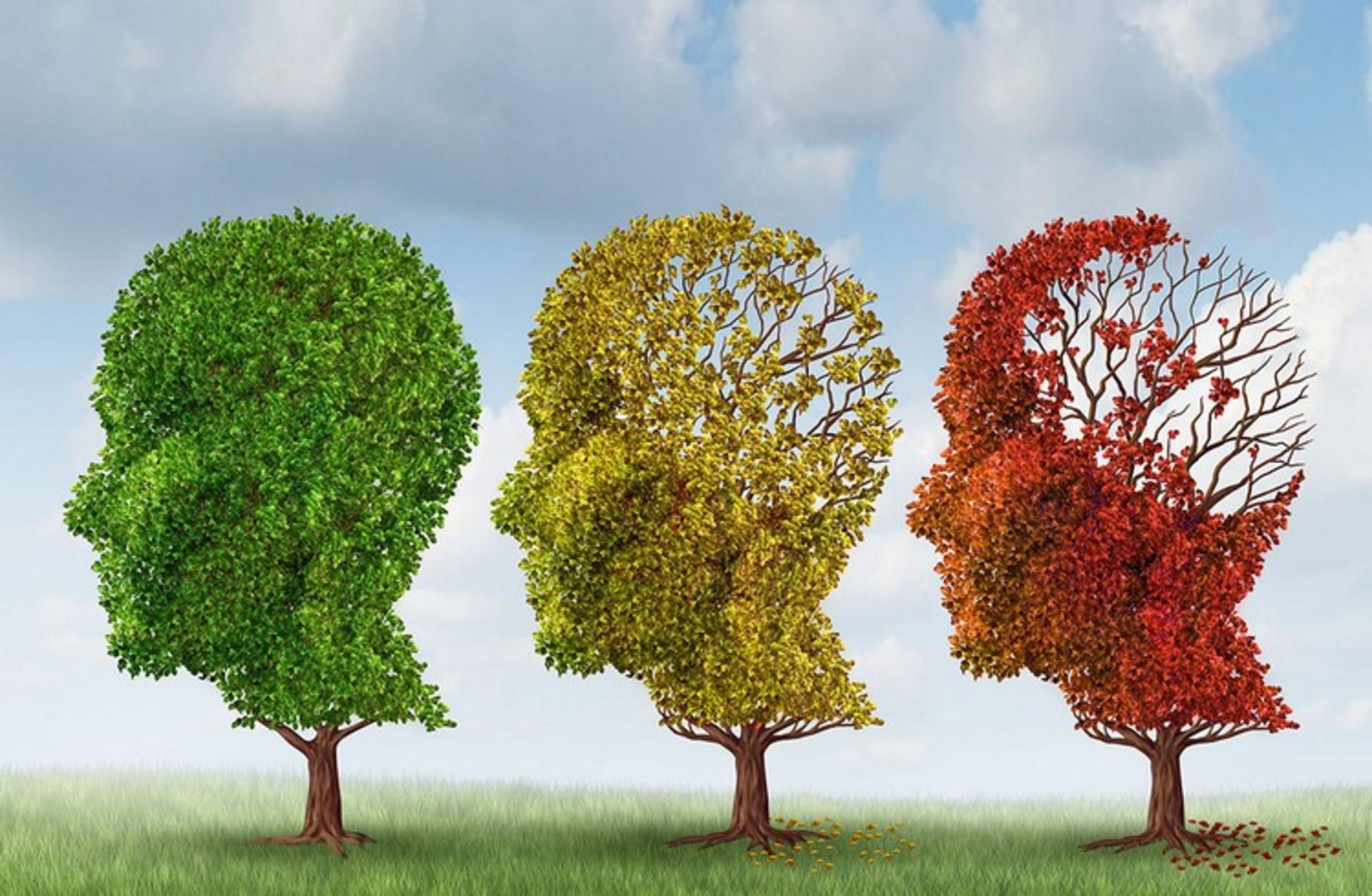 alzheimer