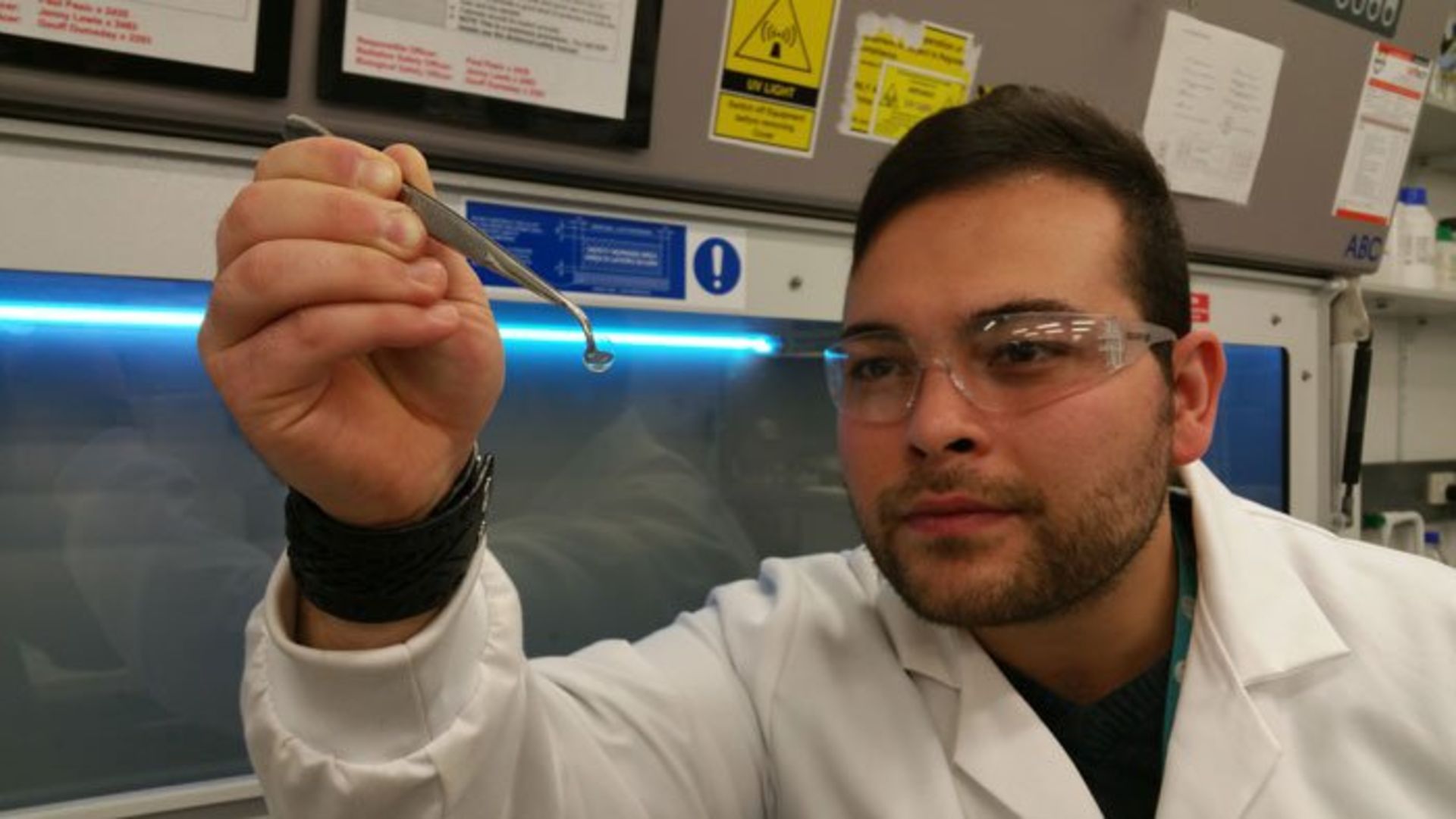 بازیابی قرنیه