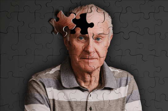 alzheimer
