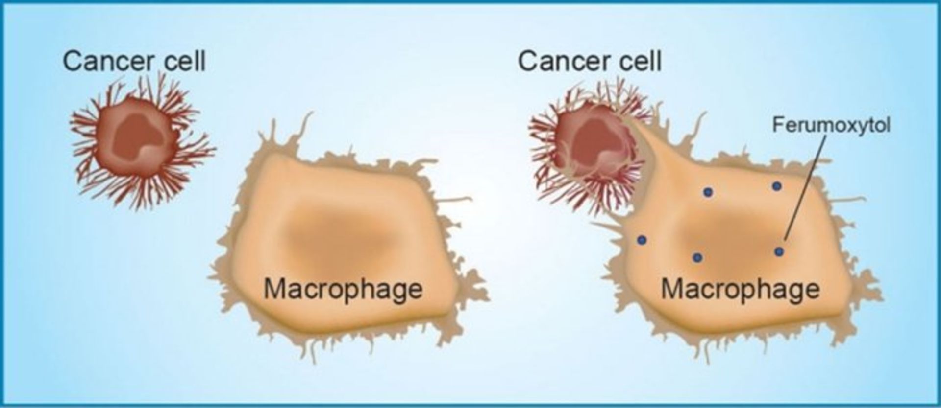 سلول سرطانی