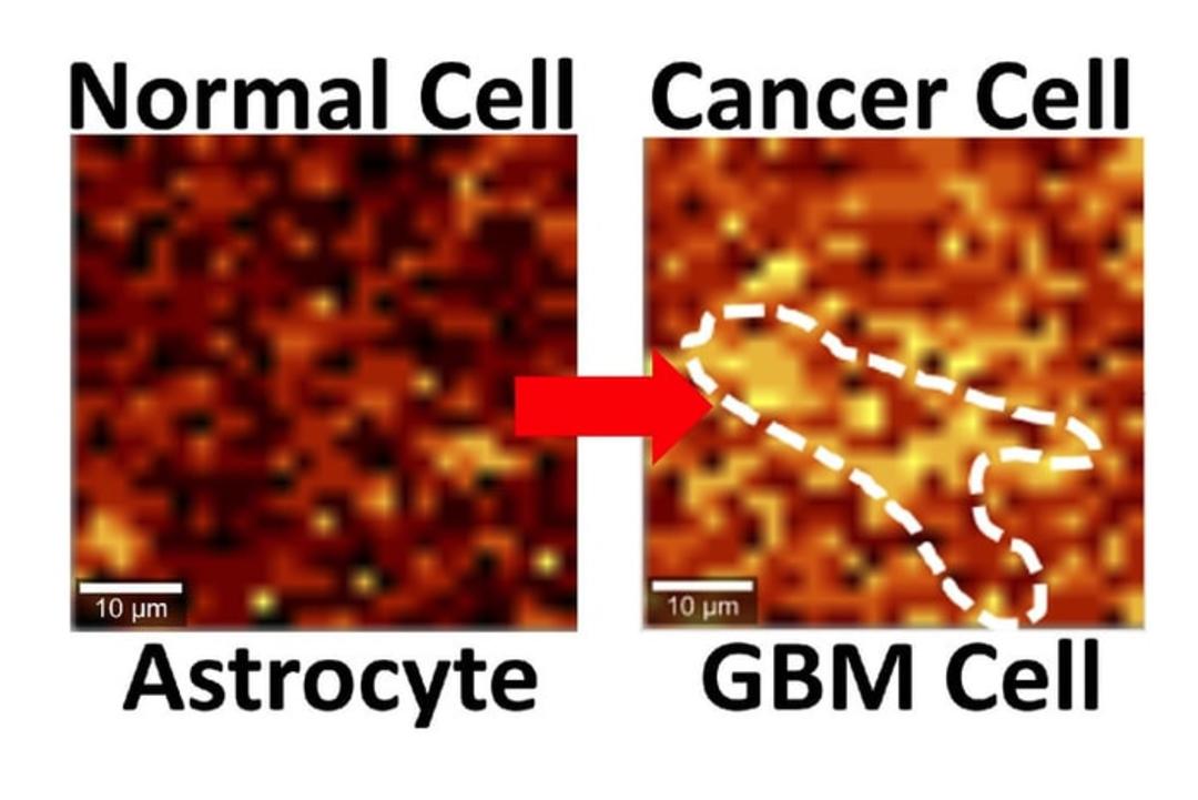 cancer cell