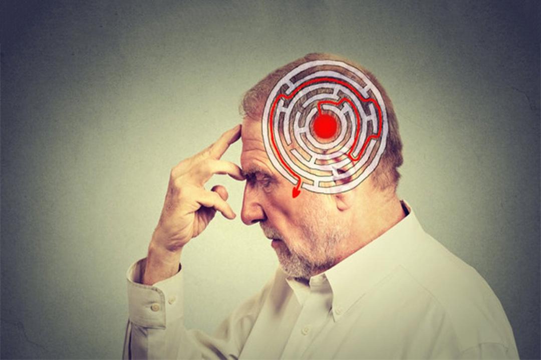 آلزایمر / alzheimer
