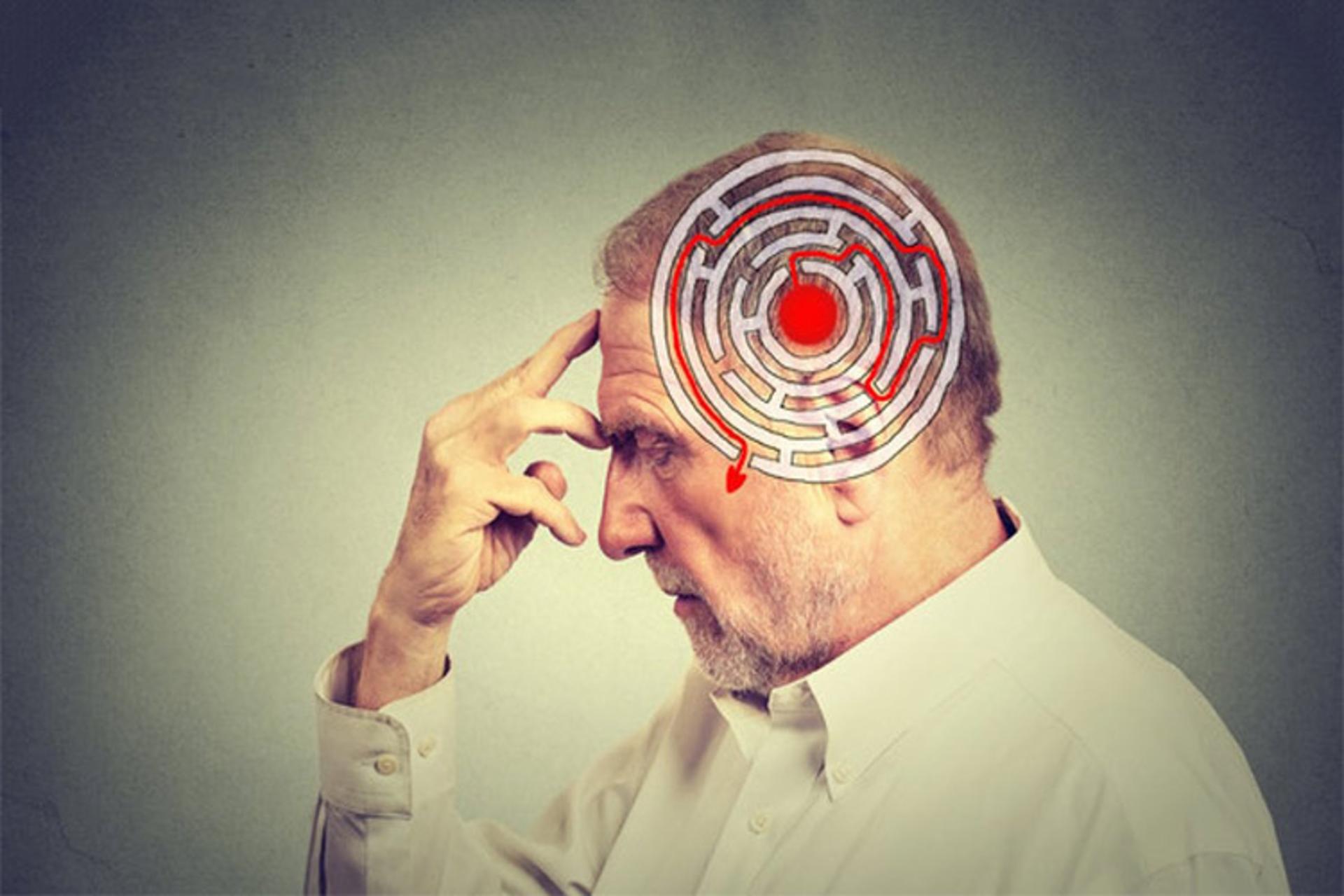 آلزایمر / alzheimer