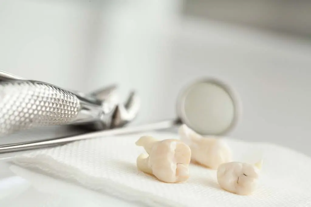 دندان عقل / Wisdom teeth