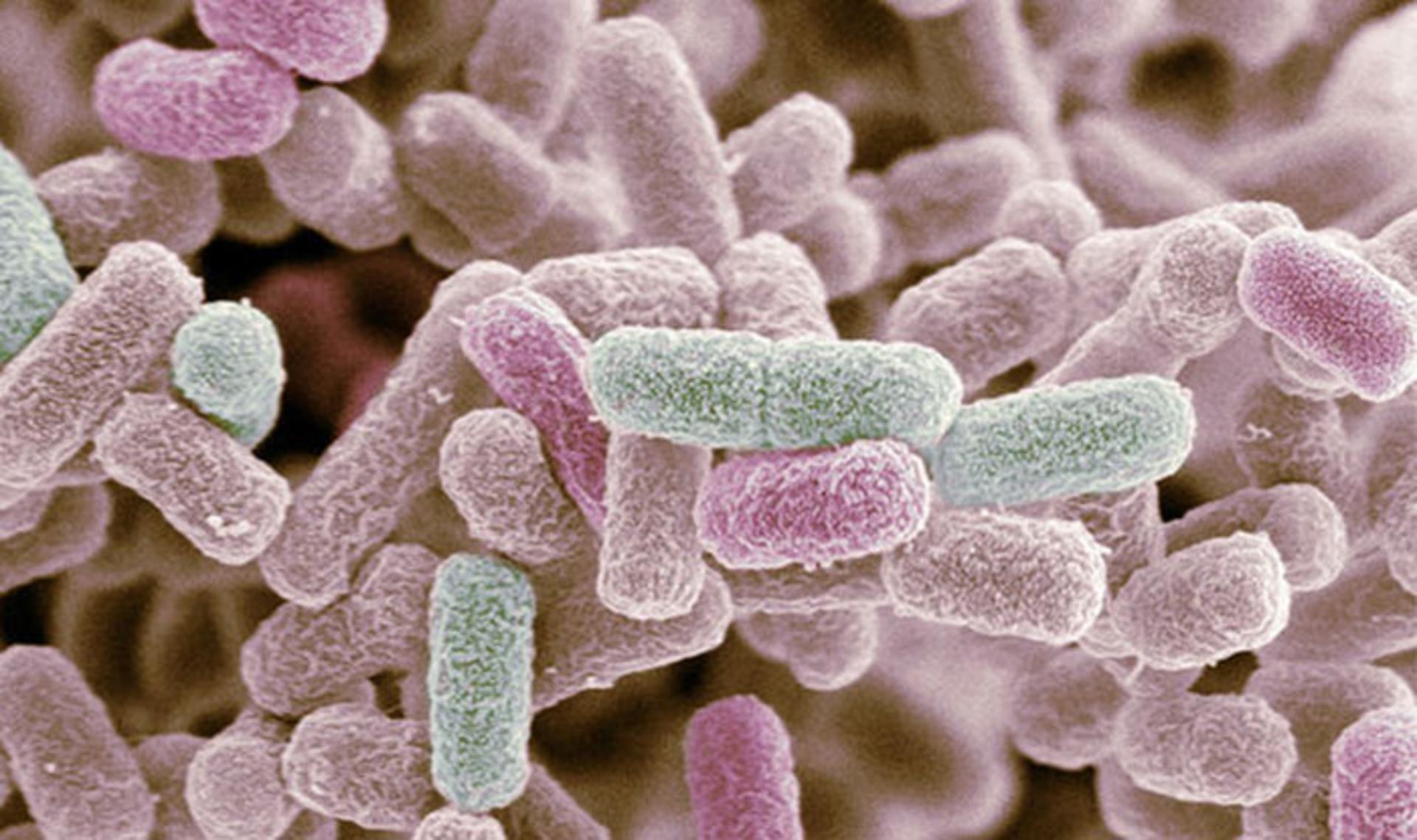 E coli