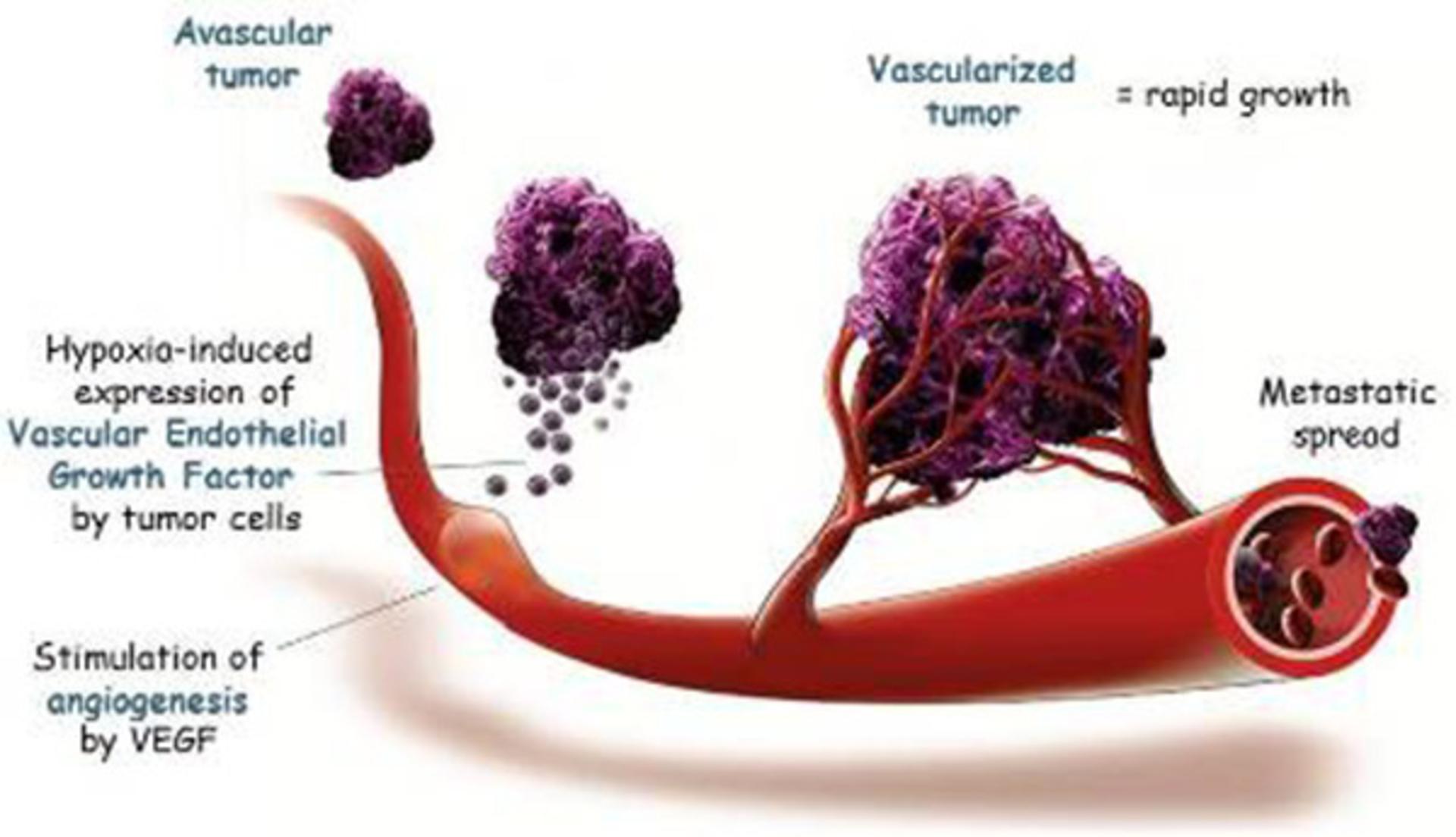 angiogenes