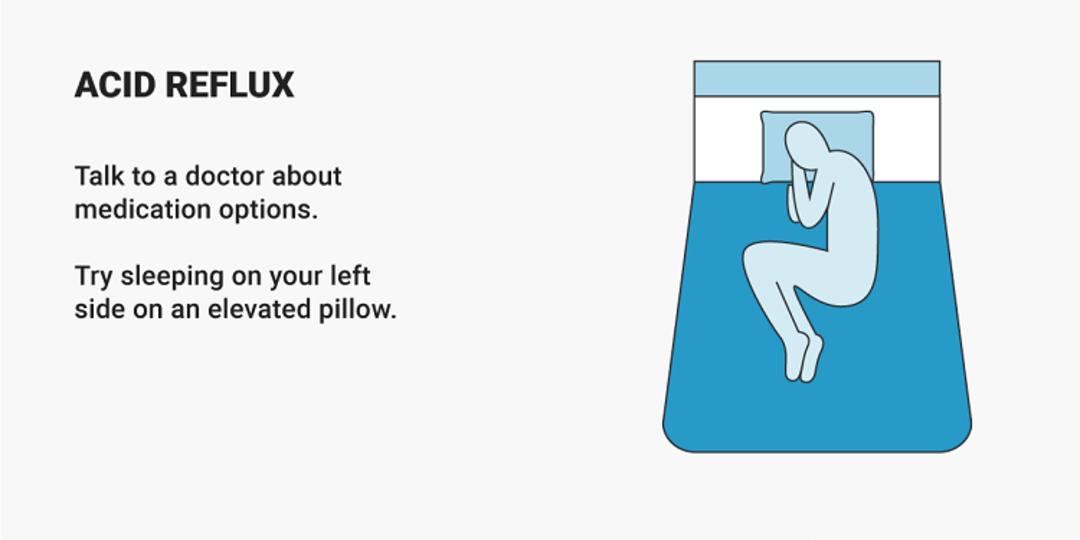 Acid reflux