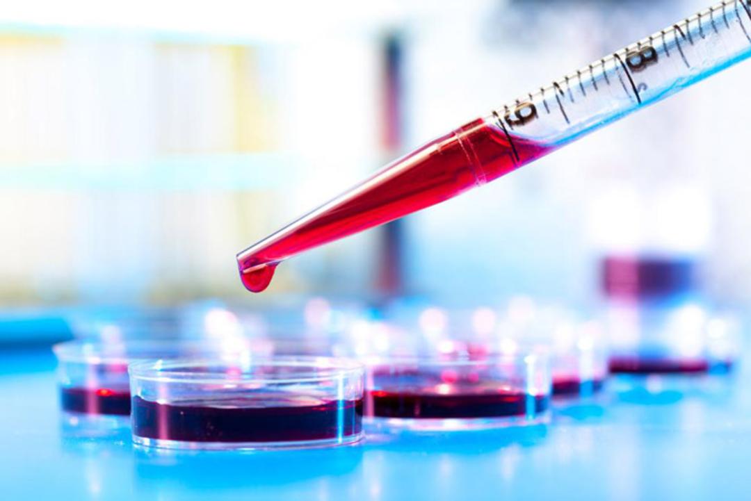 blood test