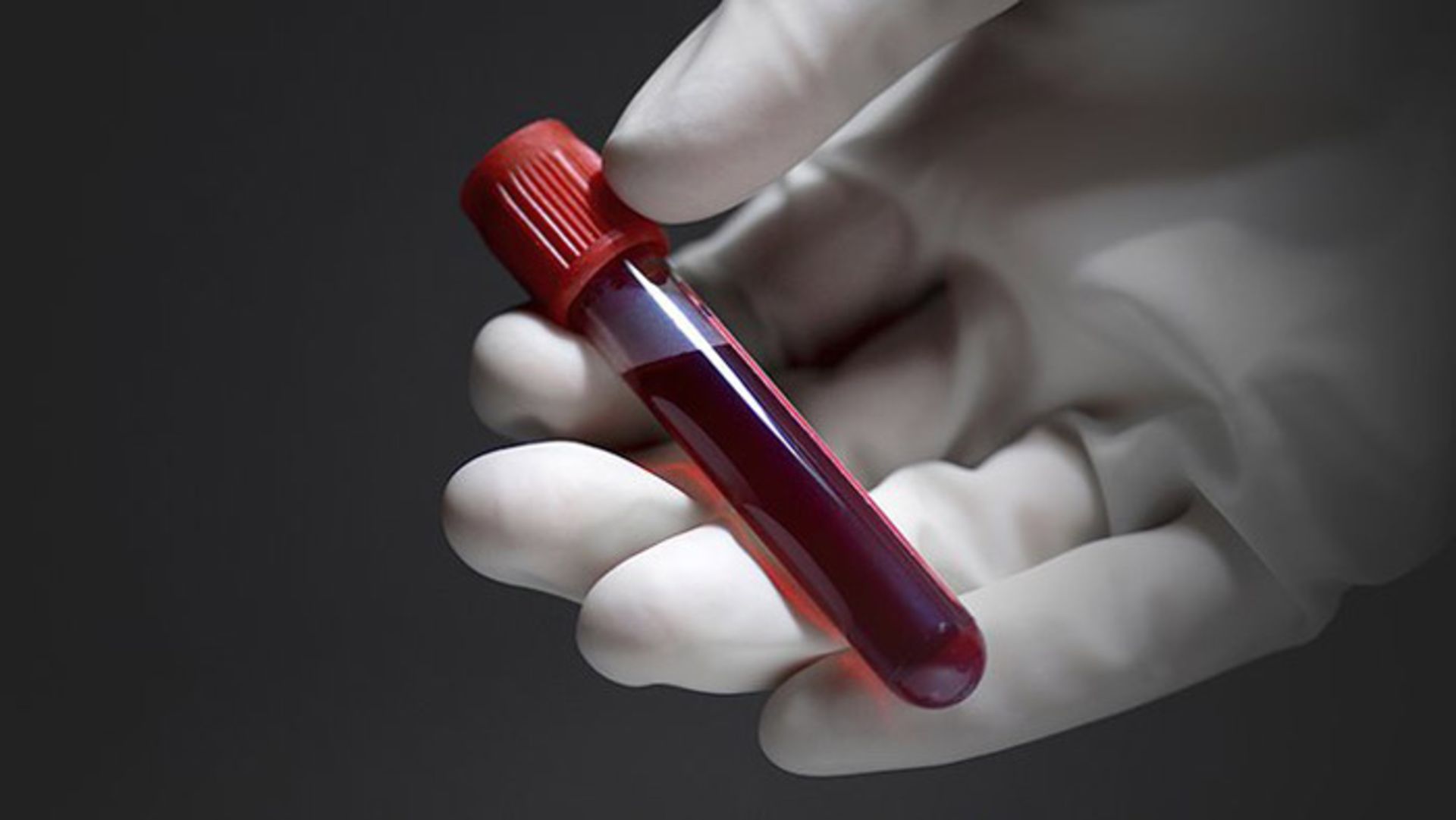 blood in tube