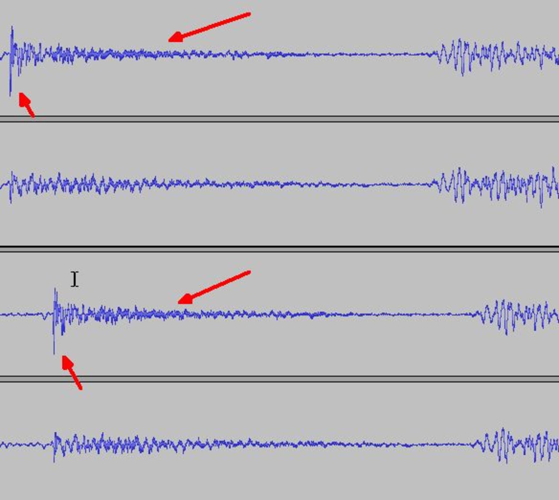 flac-vs-mp3