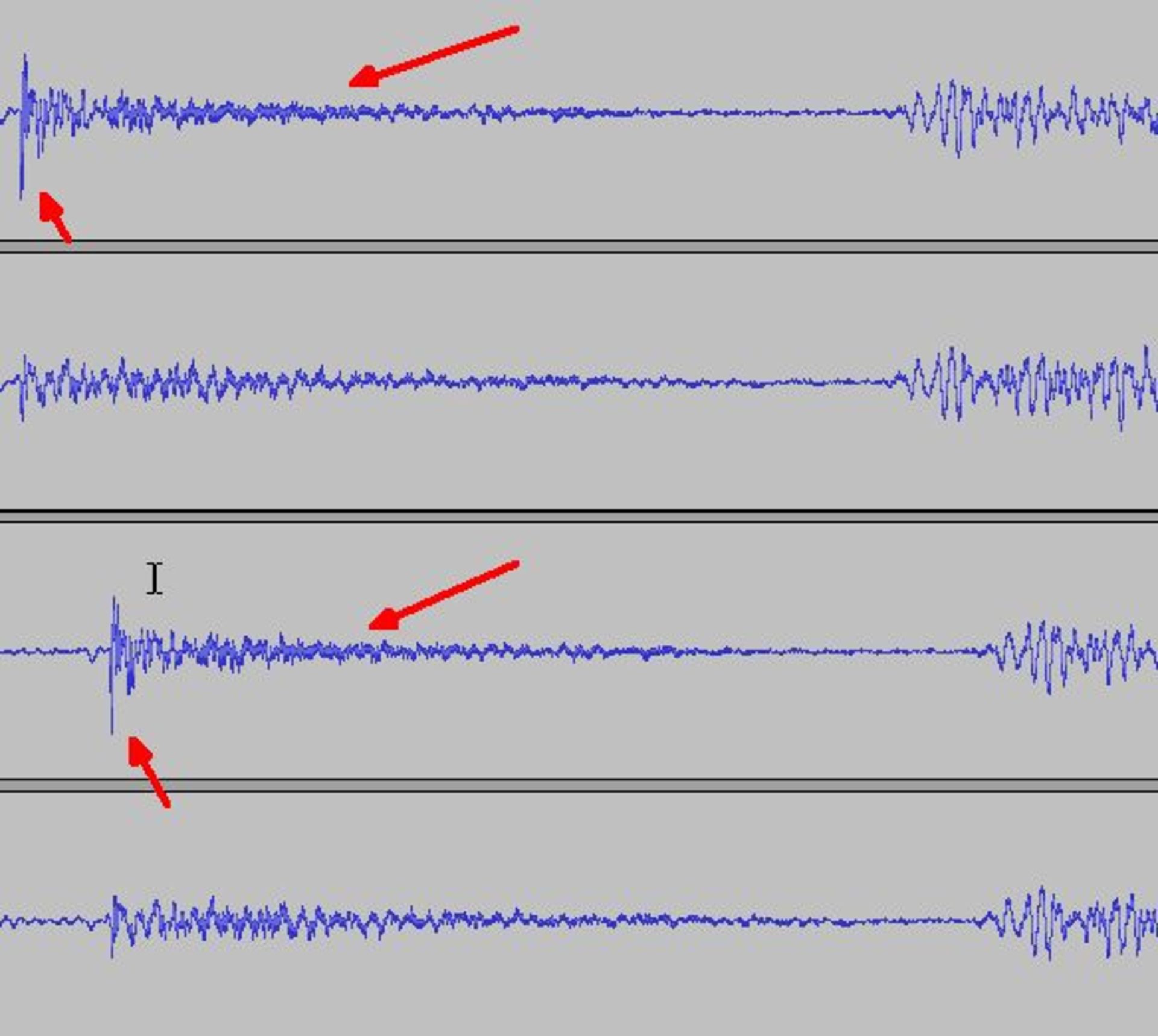 flac-vs-mp3
