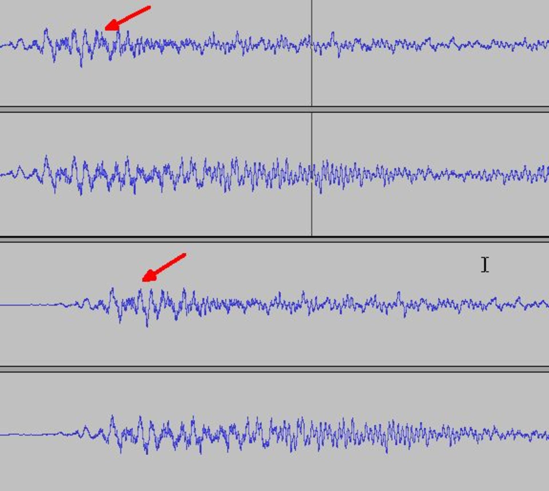 flac-vs-mp3-320