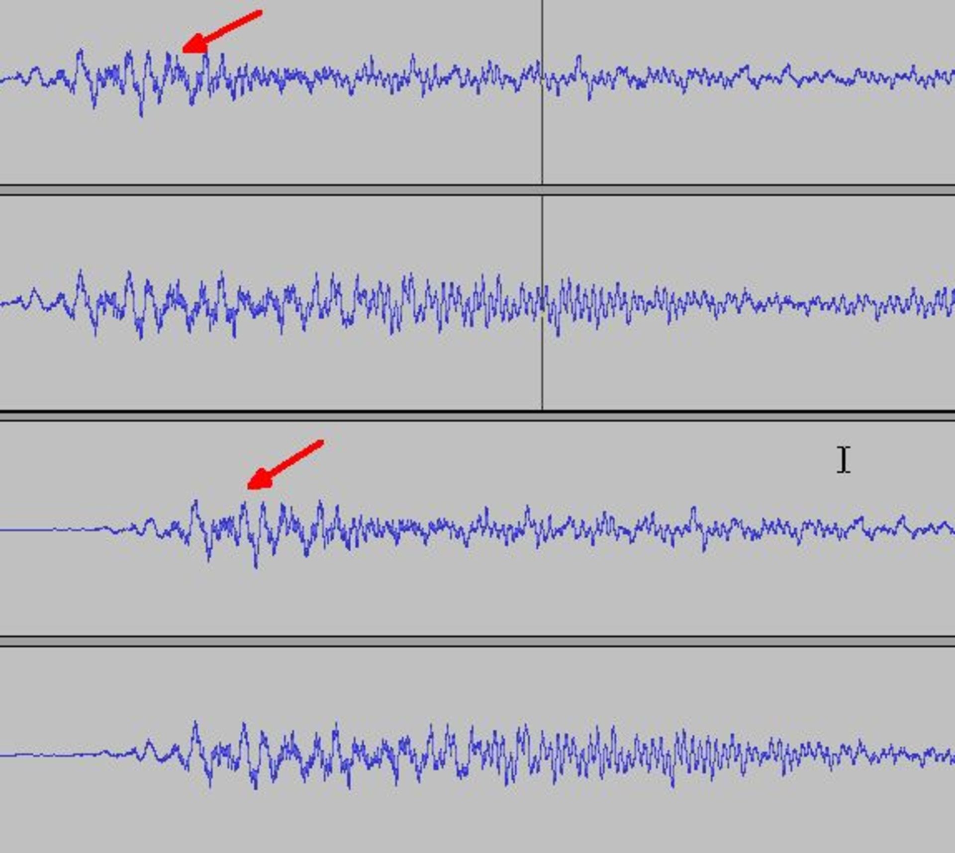 flac-vs-mp3-320