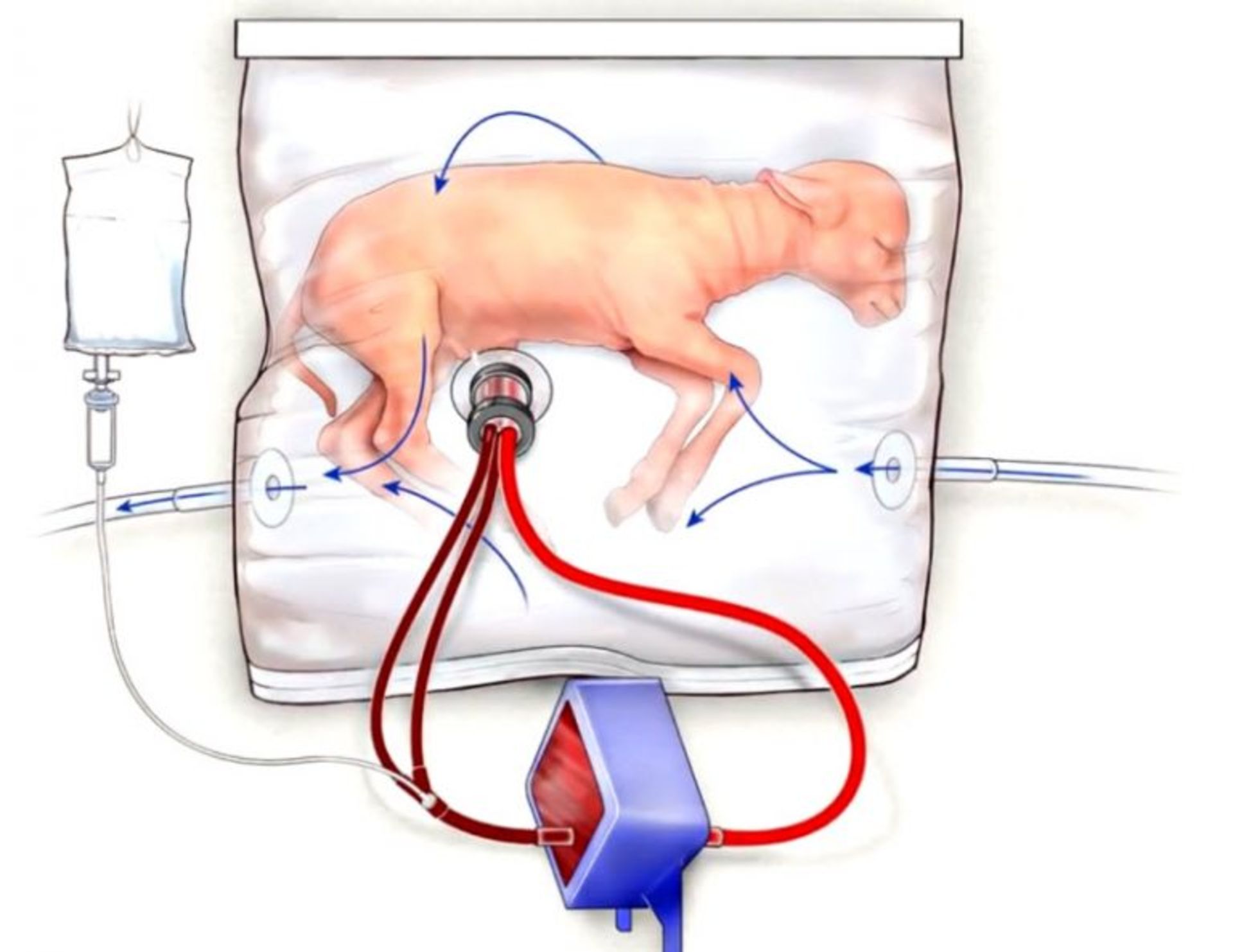 رحم مصنوعی / artificial womb