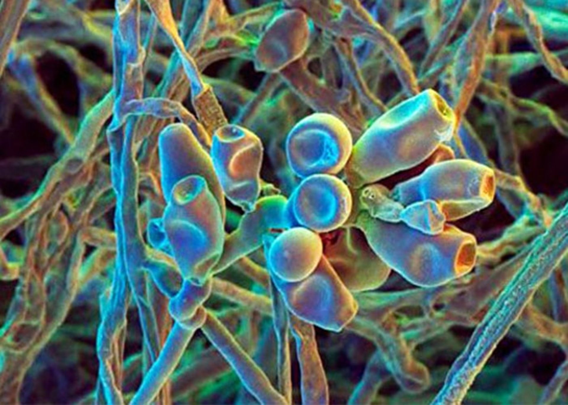 کپک عامل آلرژی