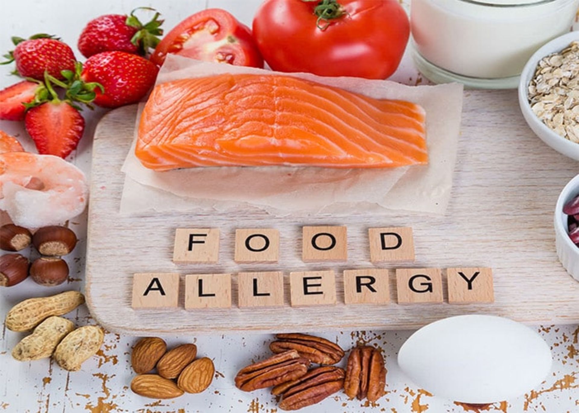 آلرژی غذایی
