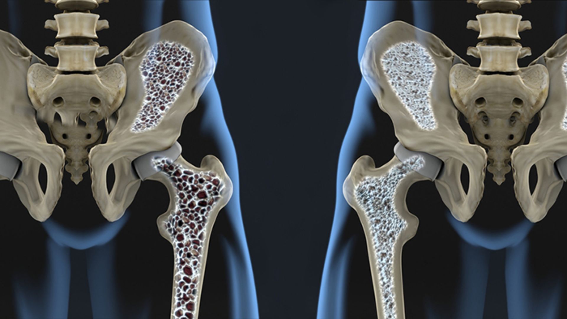 مرجع متخصصين ايران osteoporosis