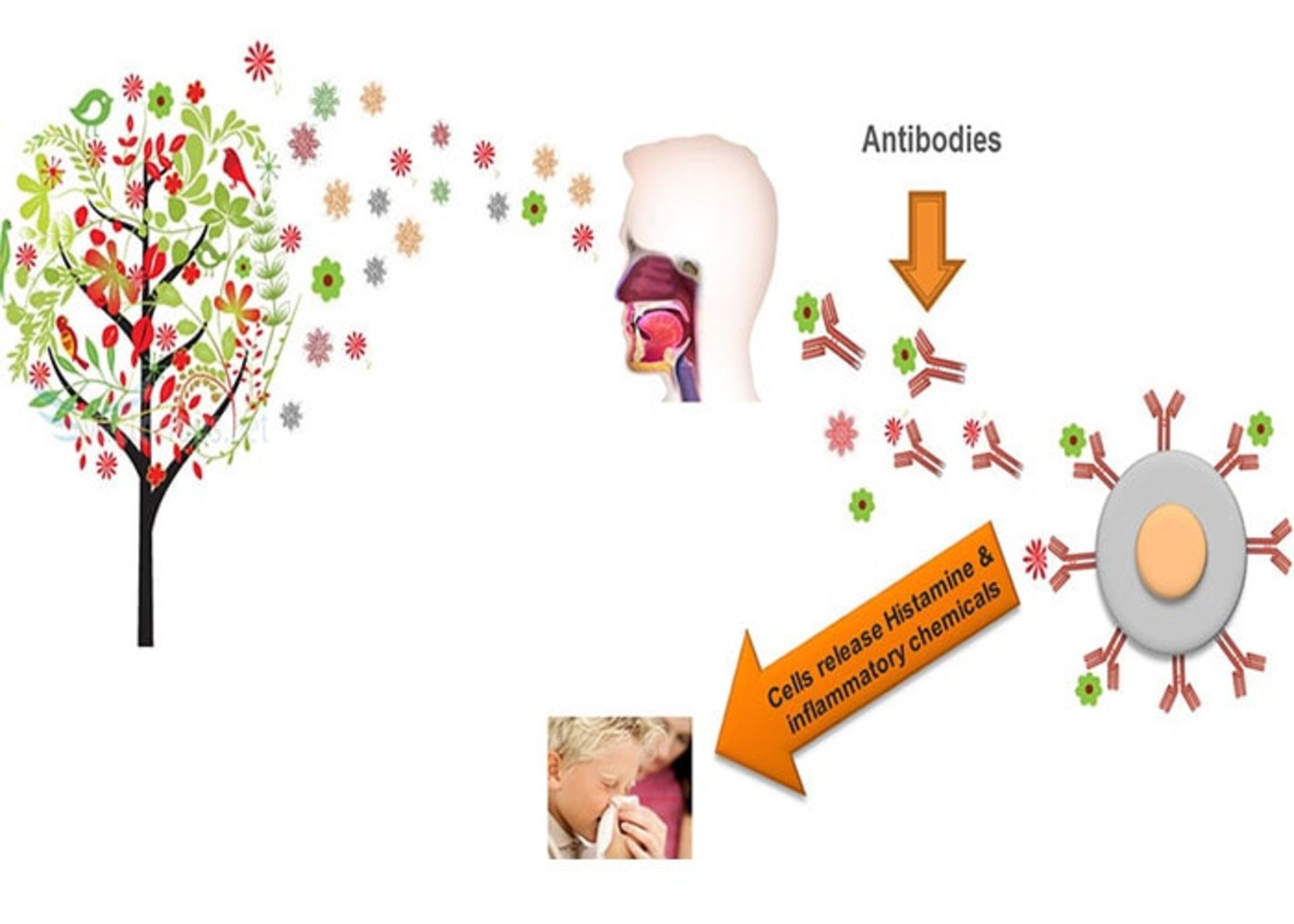 واکنش آلرژی