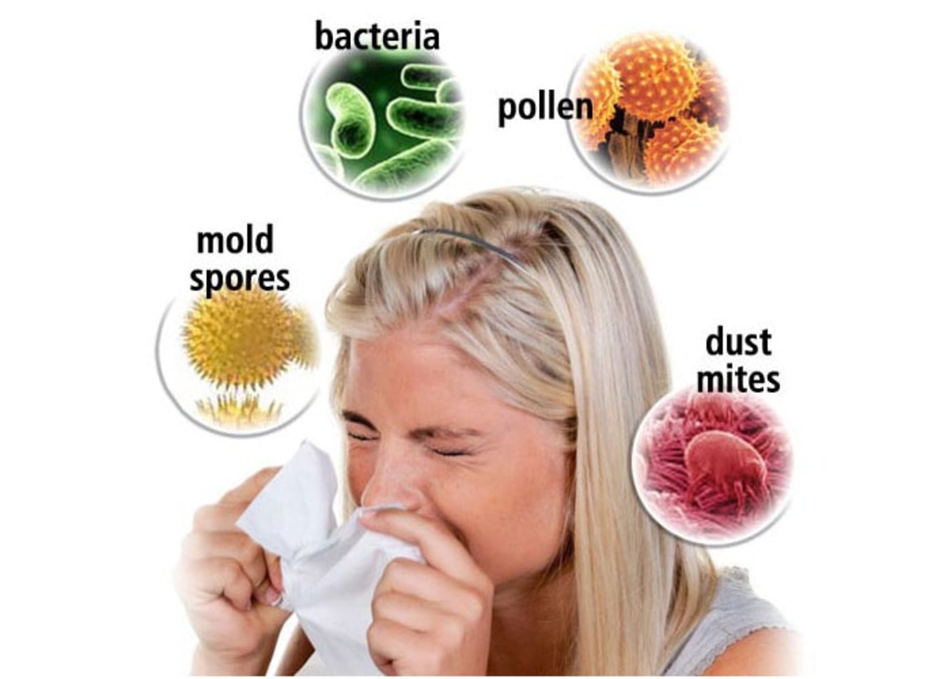 انواع آلرژی