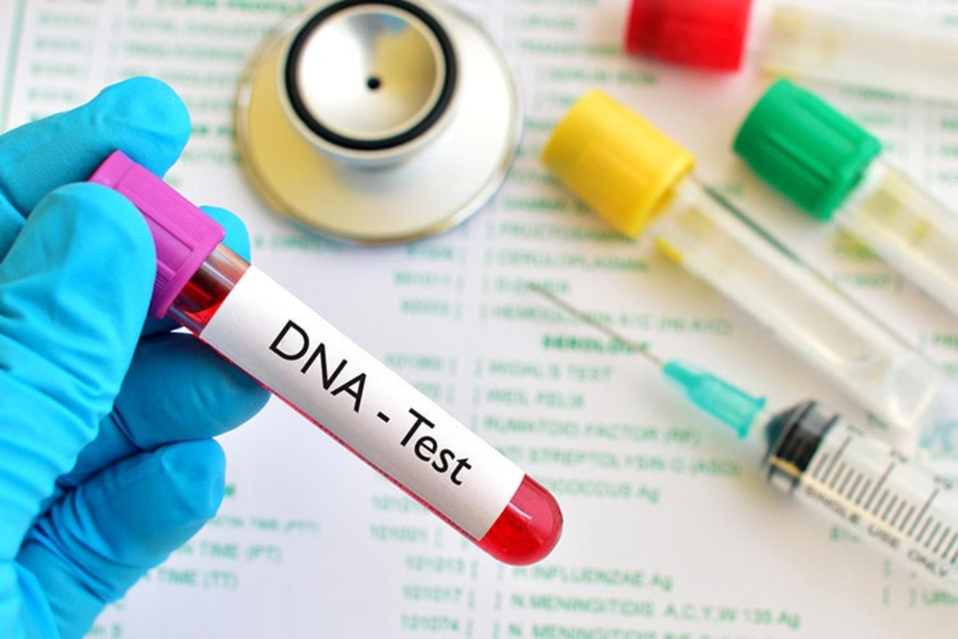آزمایش های آنلاین DNA چقدر دقیق هستند؟