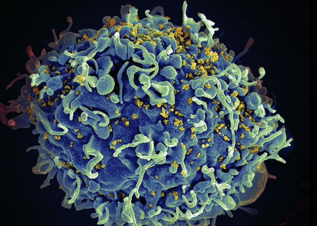 ویروس HIV