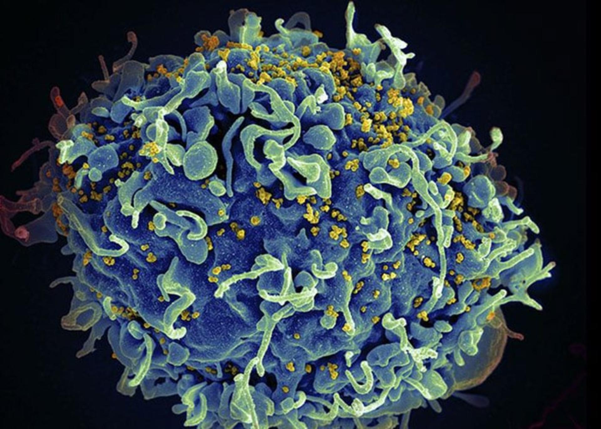 ویروس HIV