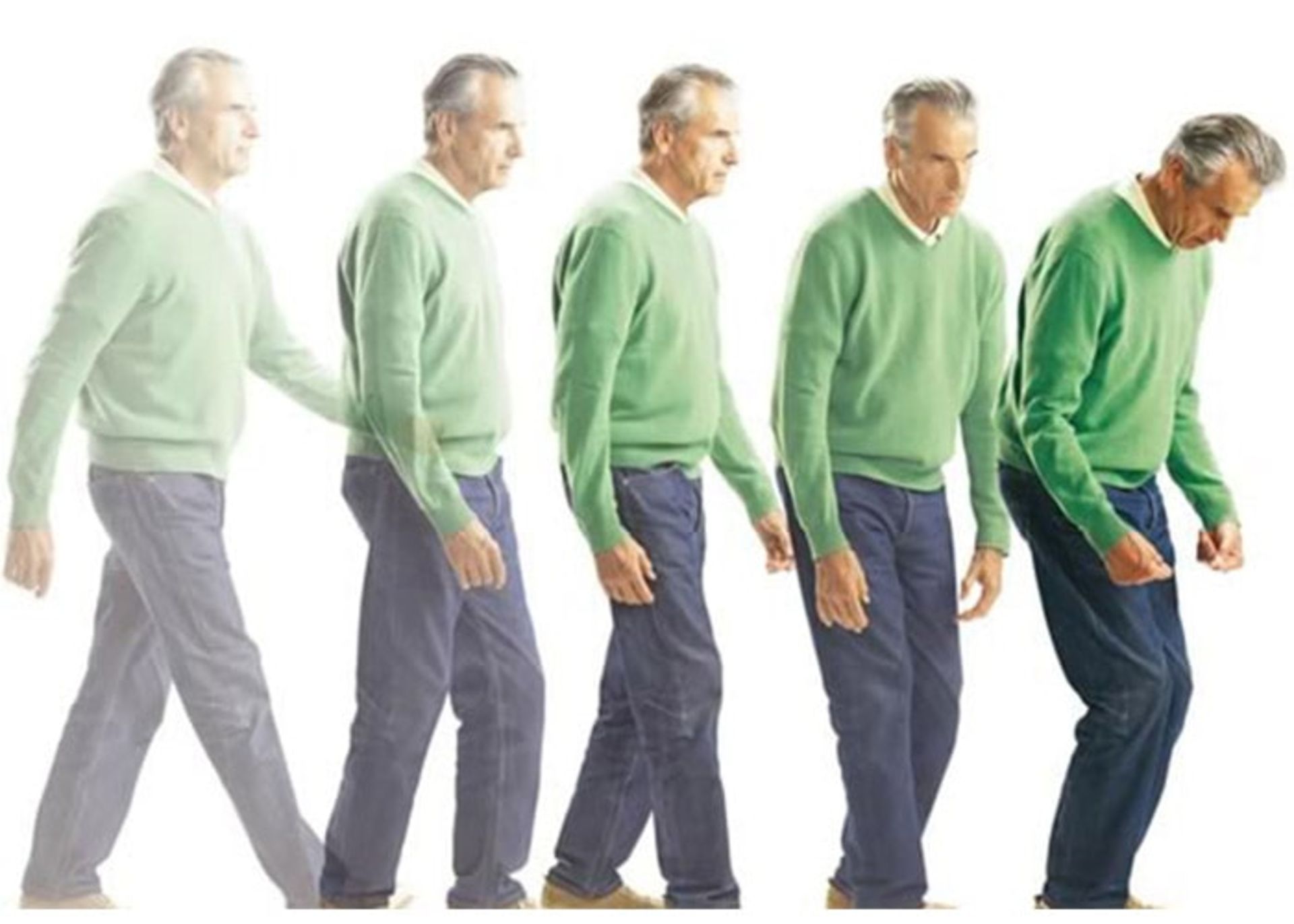 پیشرفت علایم حرکتی بیماری پارکینسون