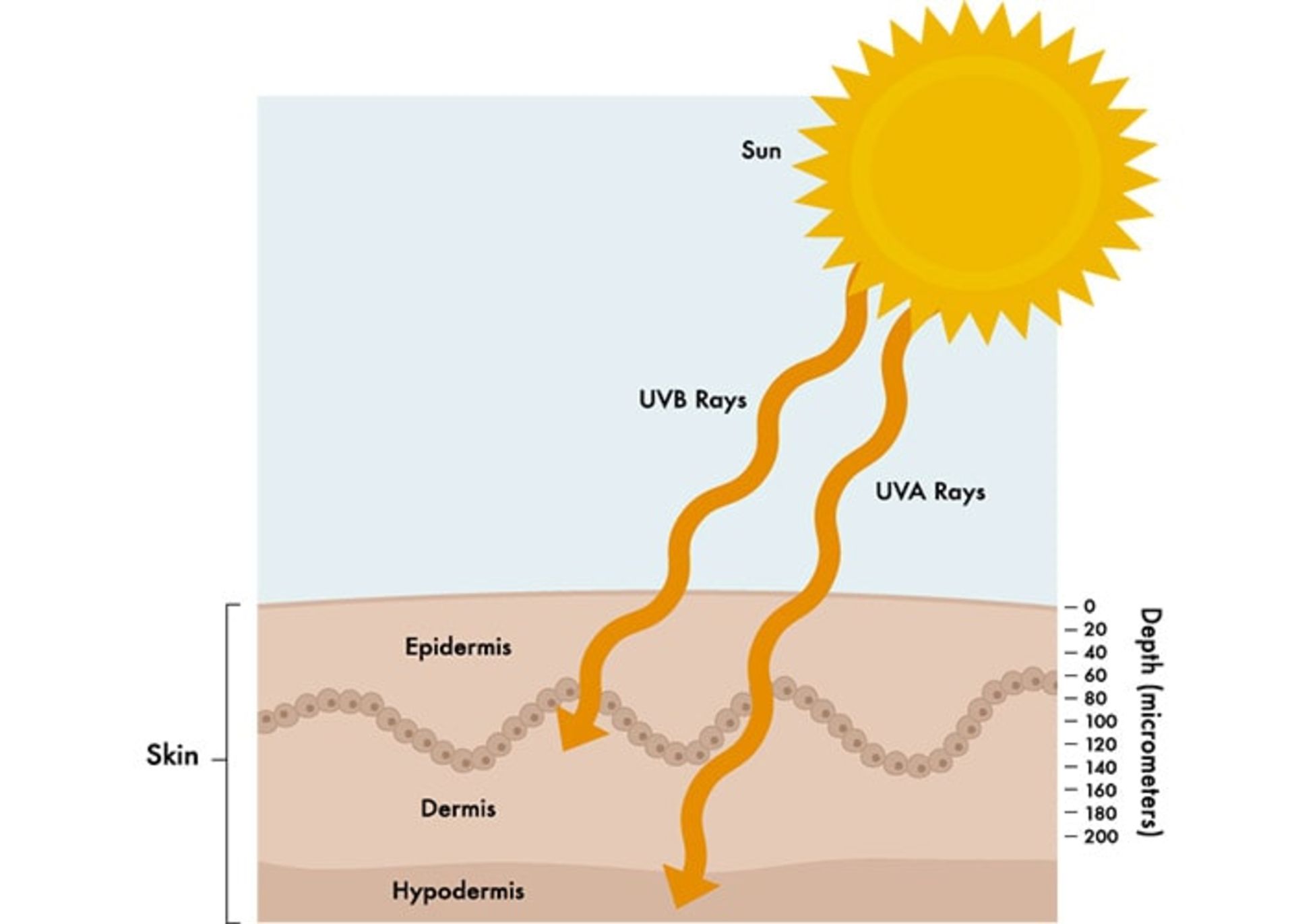 Skin cancer due to ultraviolet rays of the sun