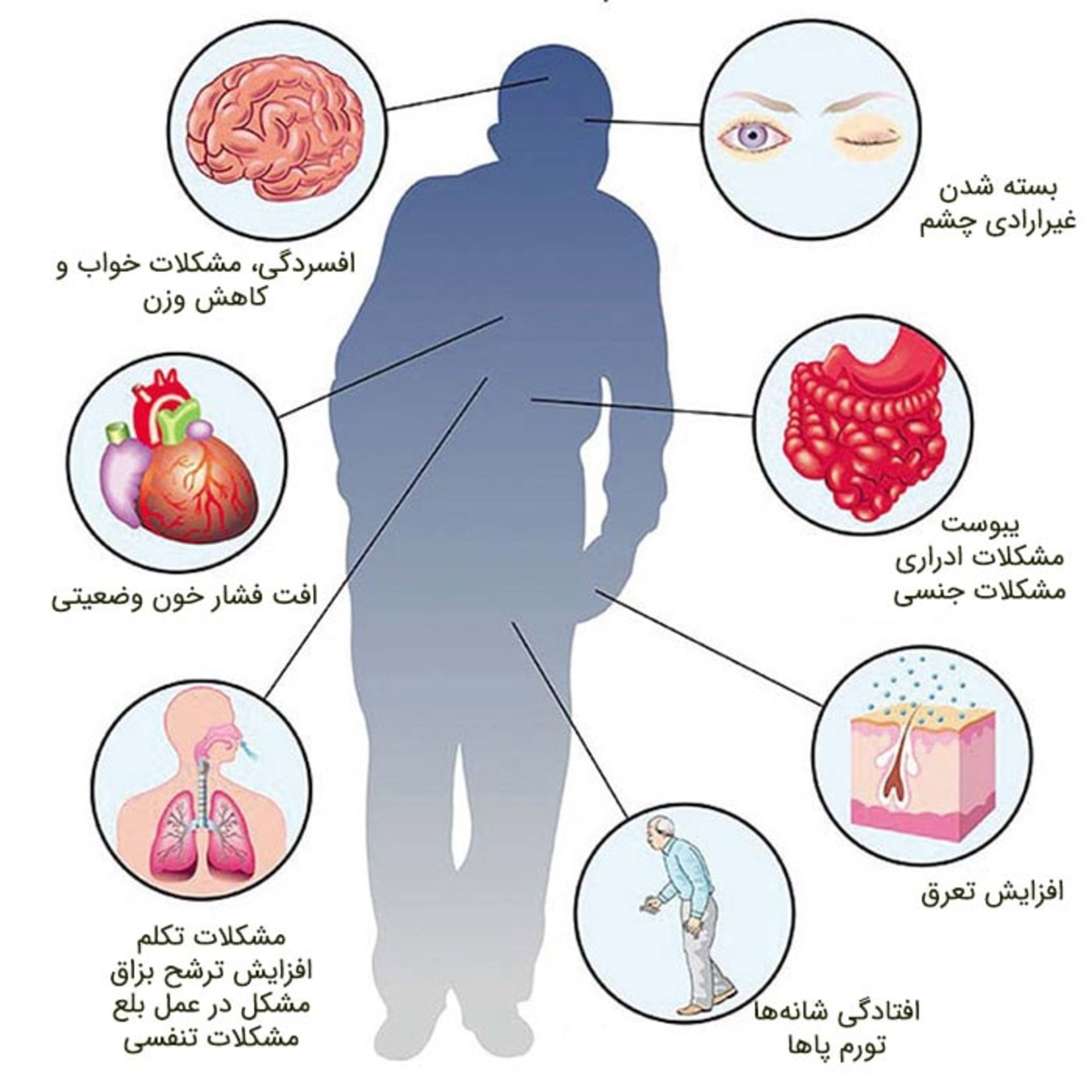 علائم و نشانه های پارکینسون