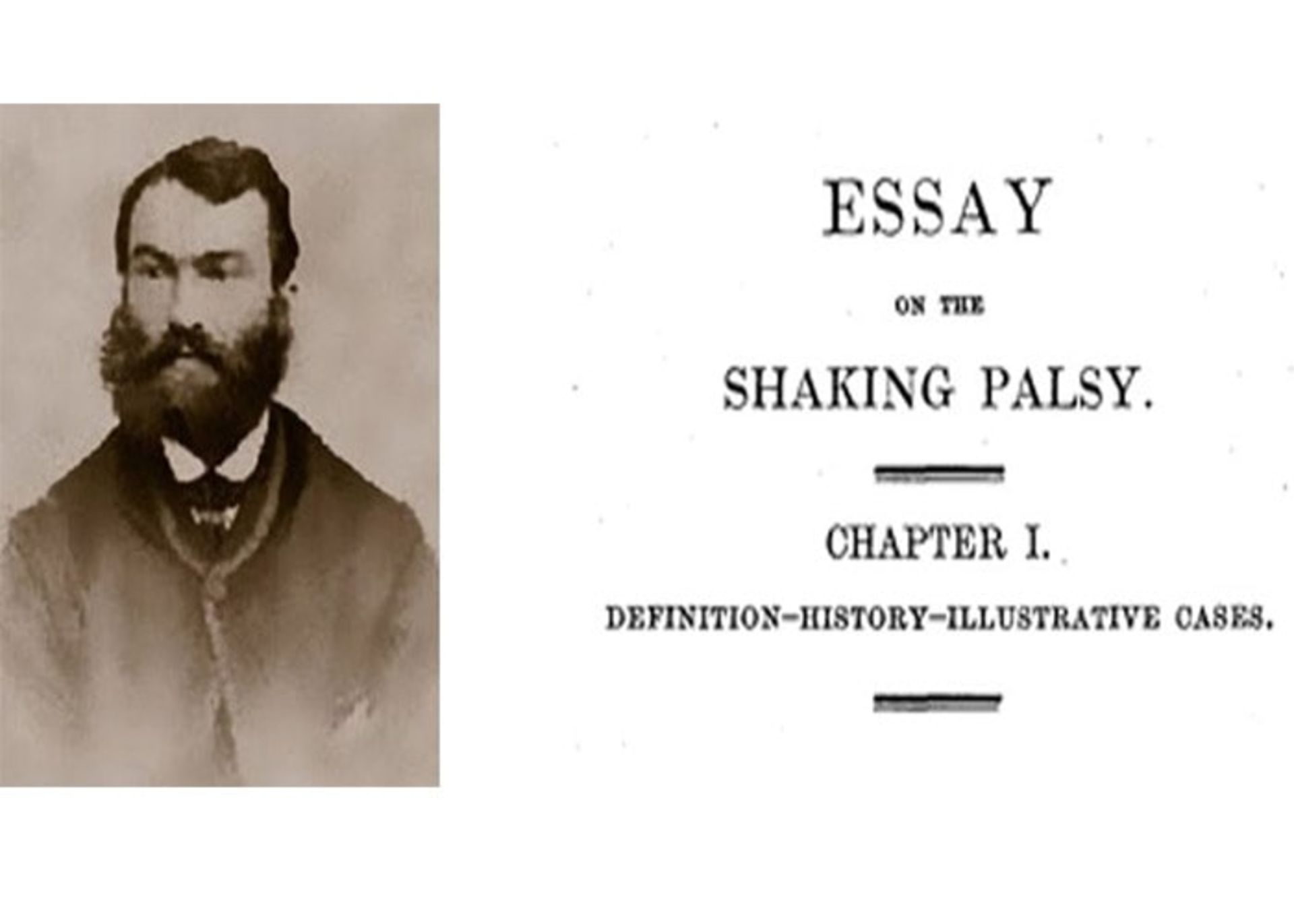 جیمز پارکینسون