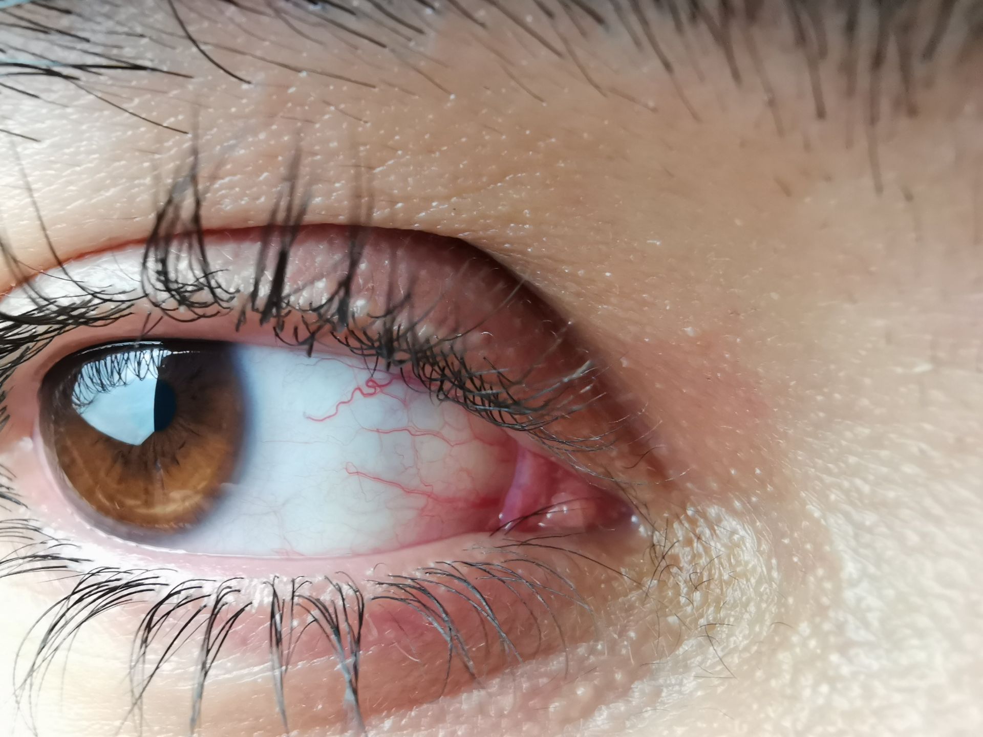 نمونه عکس ماکرو میت ۲۰