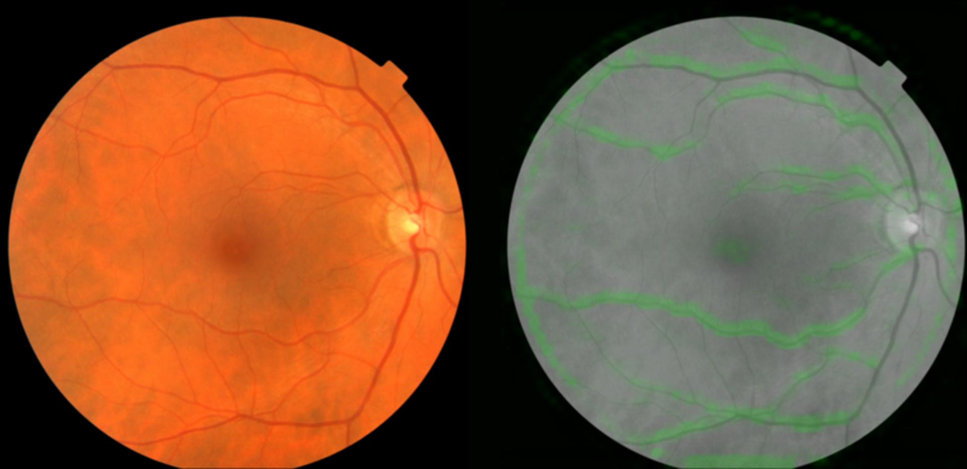 Eye scan