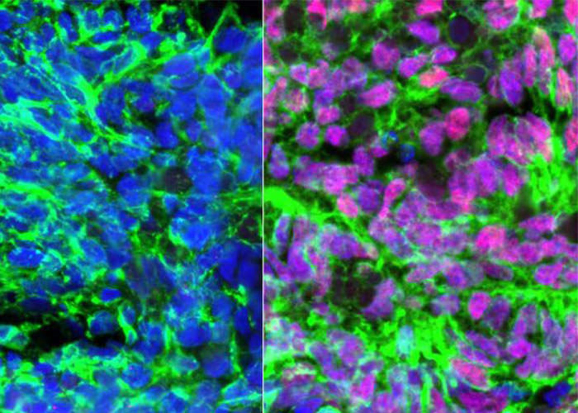 تبدیل سلول‌های بنیادی به نورون‌ها