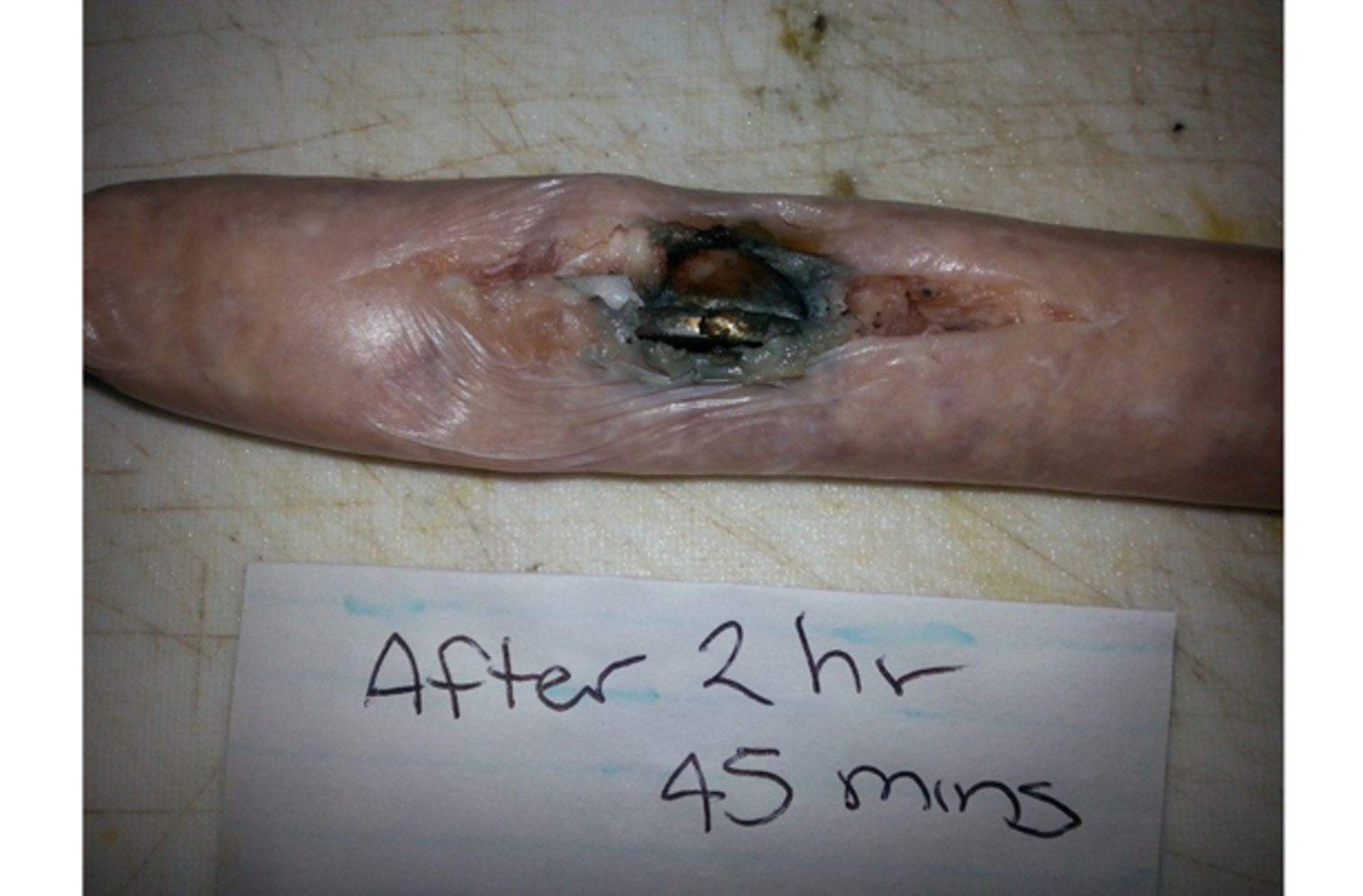 اثر باتری دکمه‌ای روی سوسیس پس از 2 ساعت !