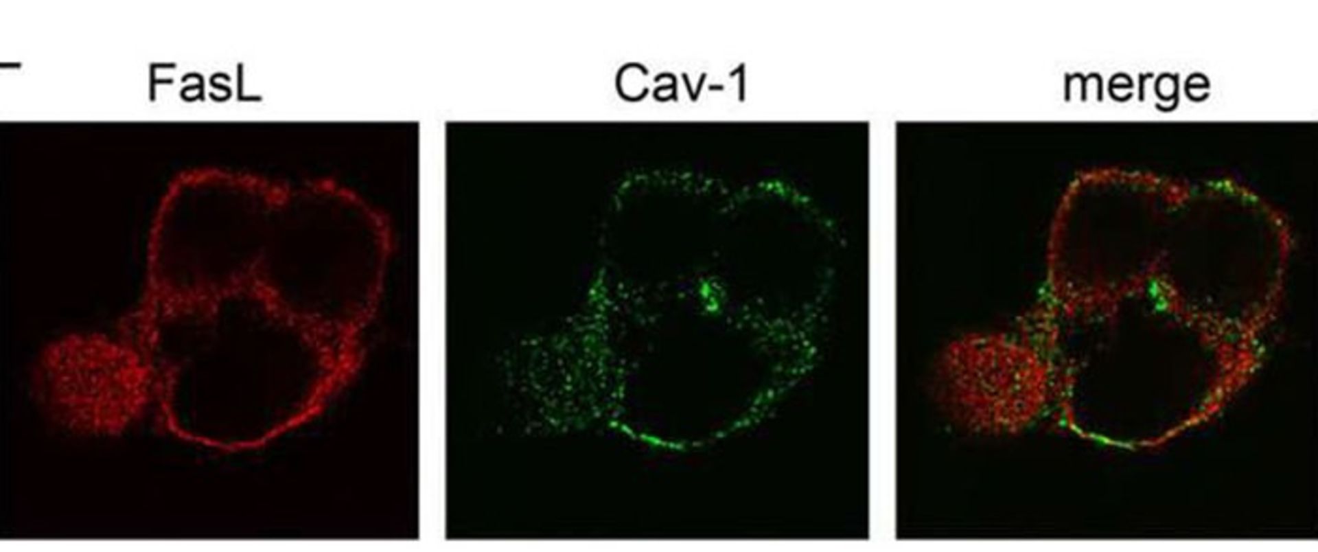 مکانیسم مرگ سلولی