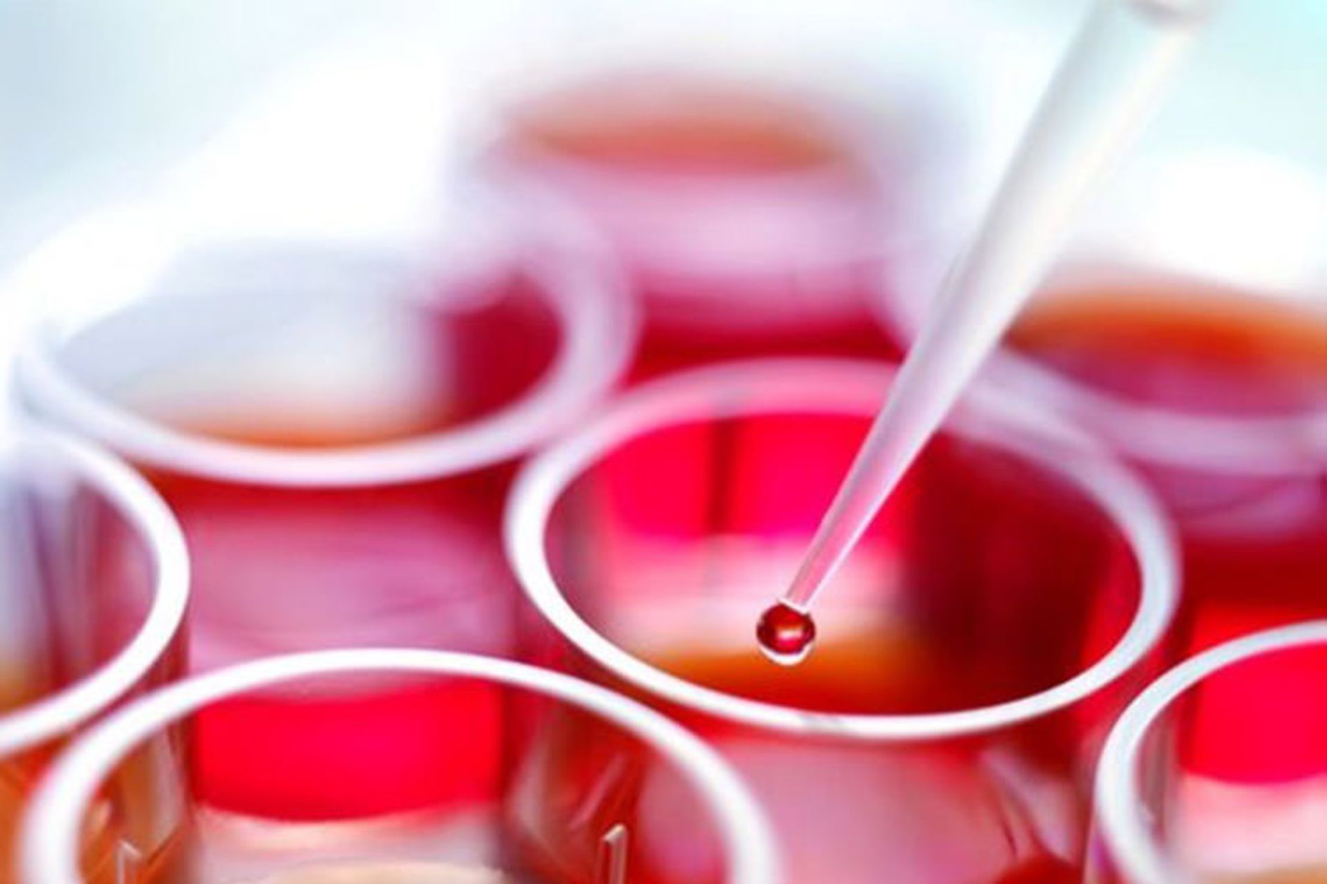 آزمایش سلول های بنیادی ریه