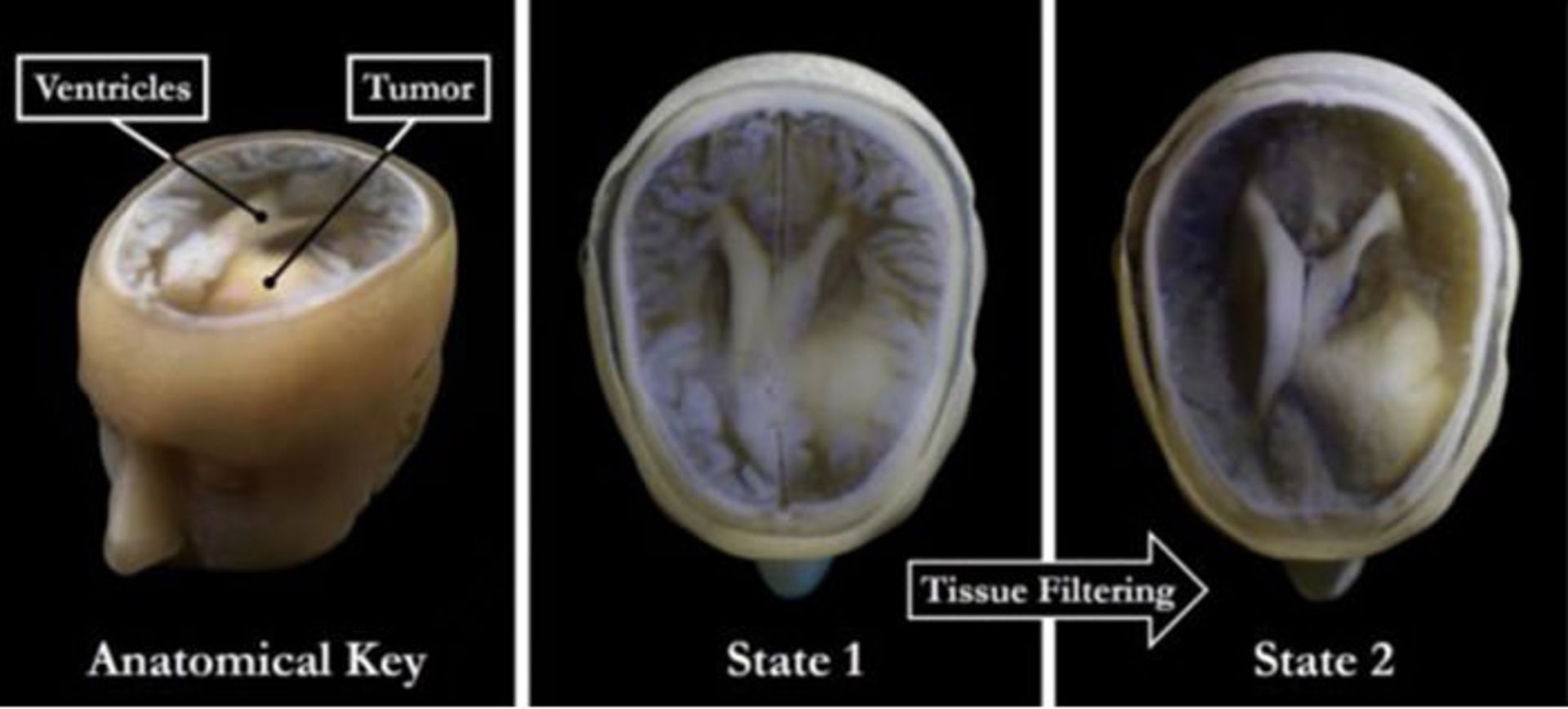 تصویر سه بعدی از مغز استیون کیتینگ