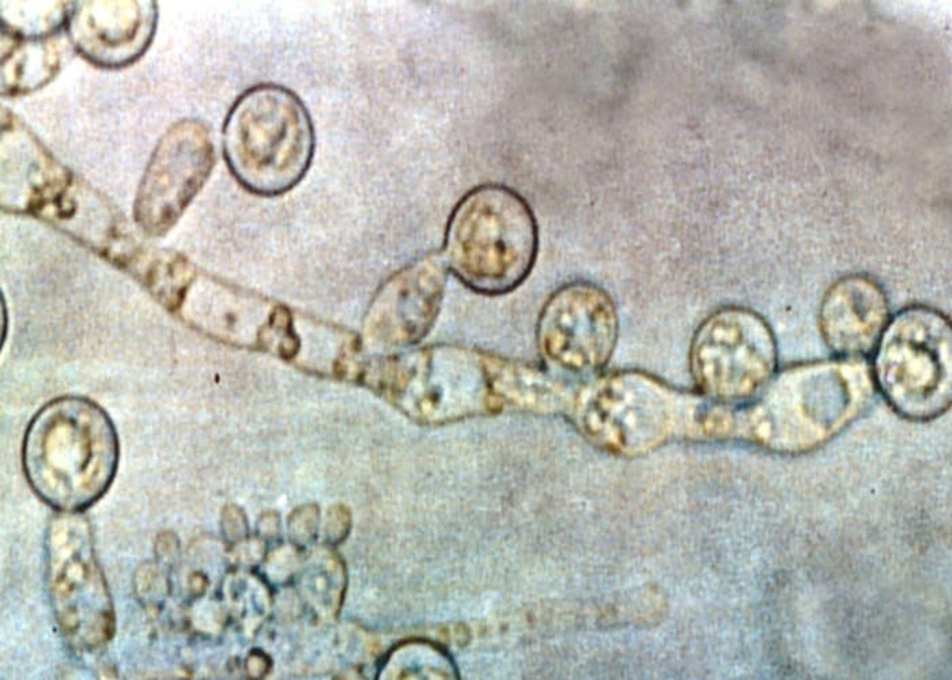 کاندیدا آلبیکانس