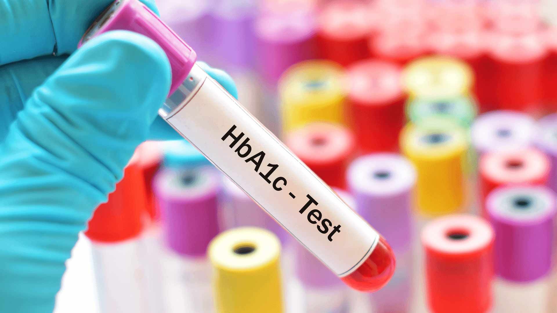  آزمایش هموگلوبین / hba1c test