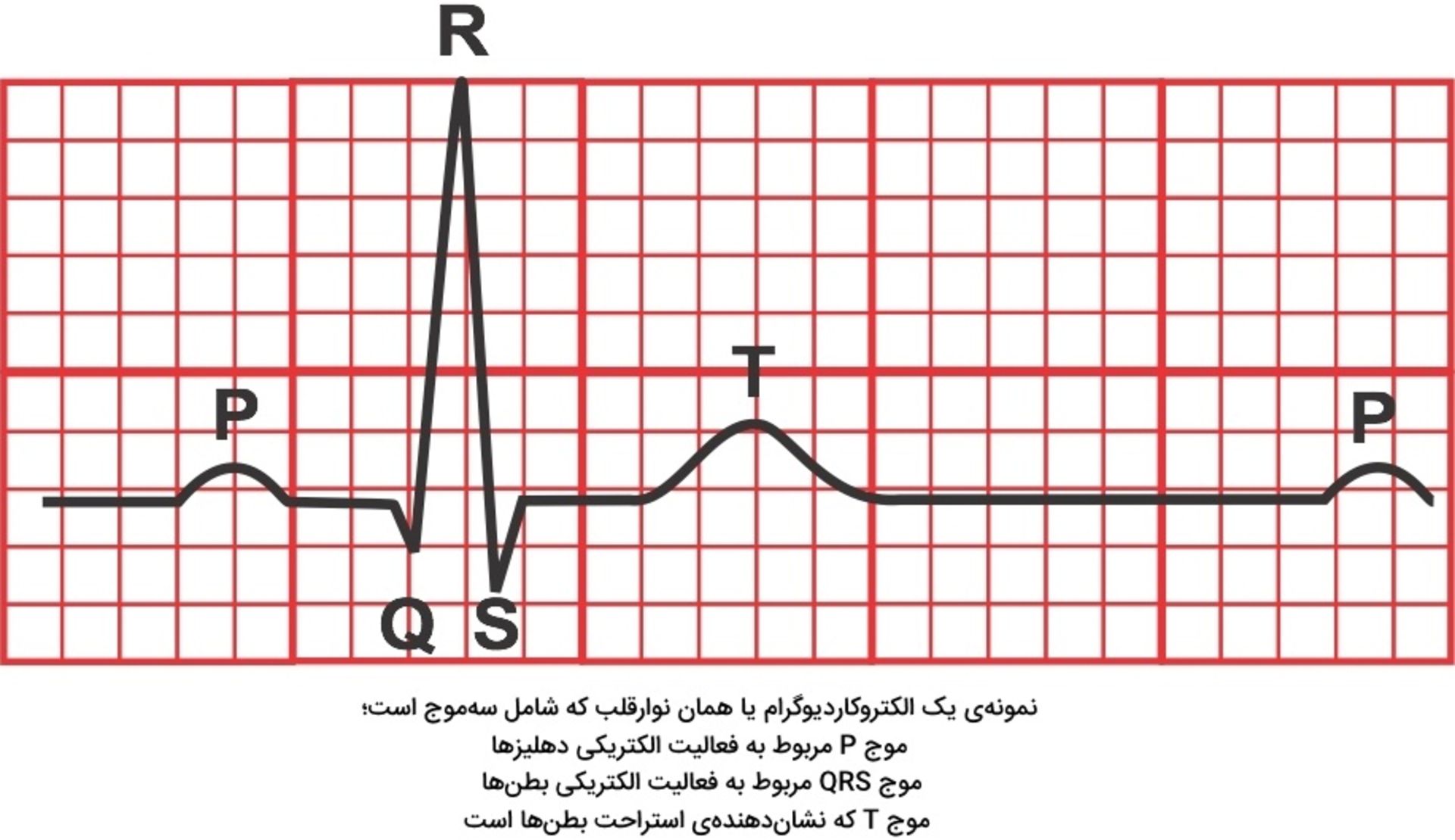 مرجع متخصصين ايران نوار قلب / الكتروكارديوگرام / ECG / EKG