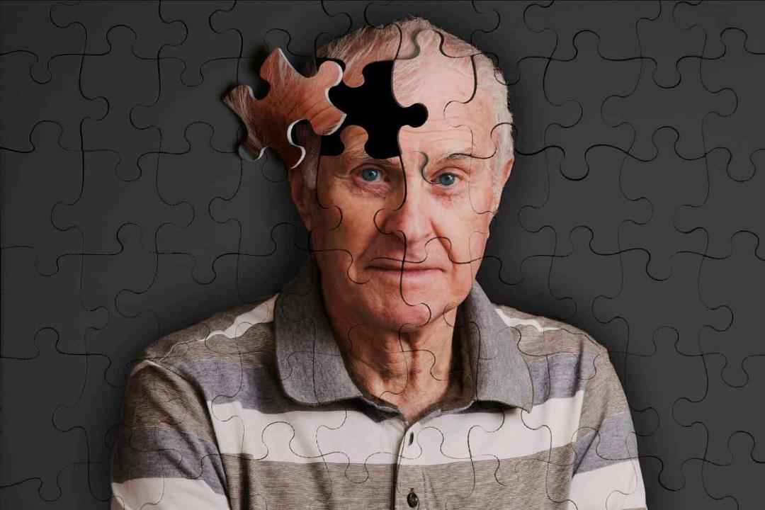 آلزایمر /  Alzheimer