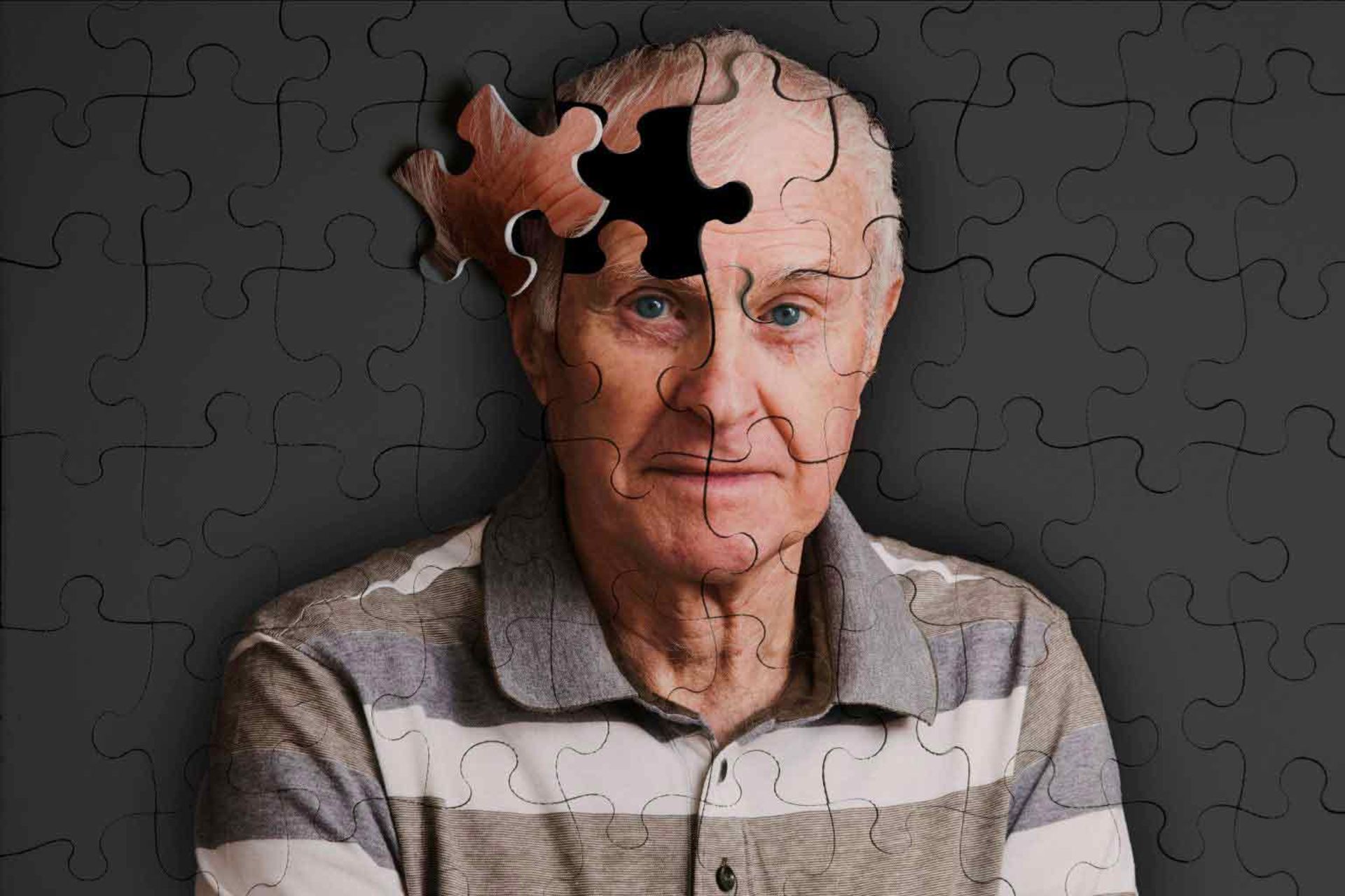 آلزایمر /  Alzheimer