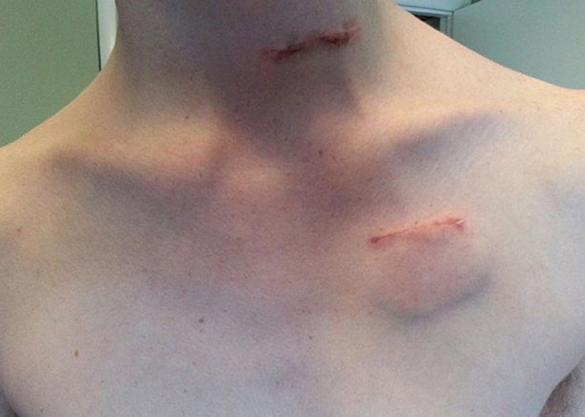 دستگاه محرک تولید کننده پالس الکتریکی