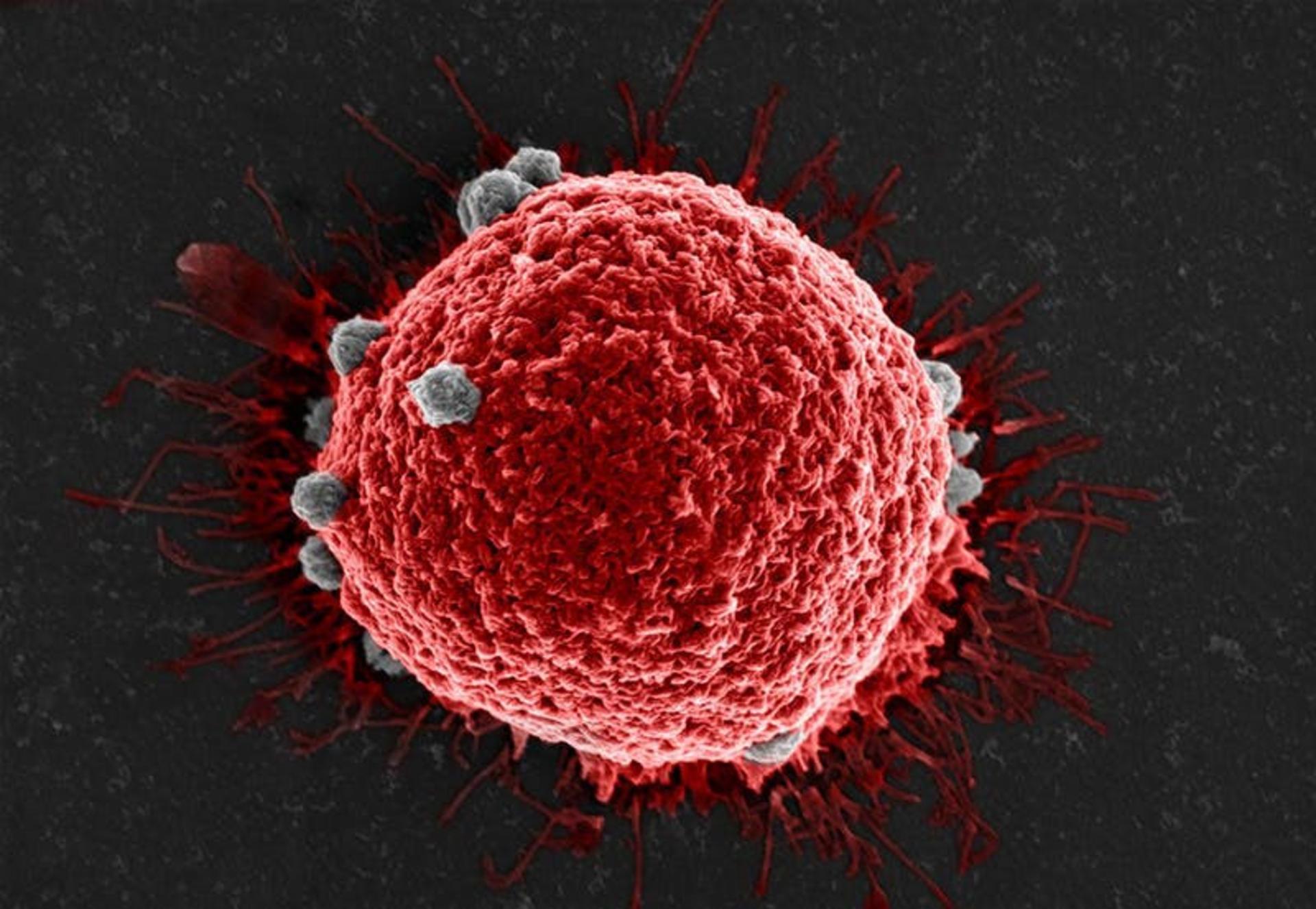تومور / tumor