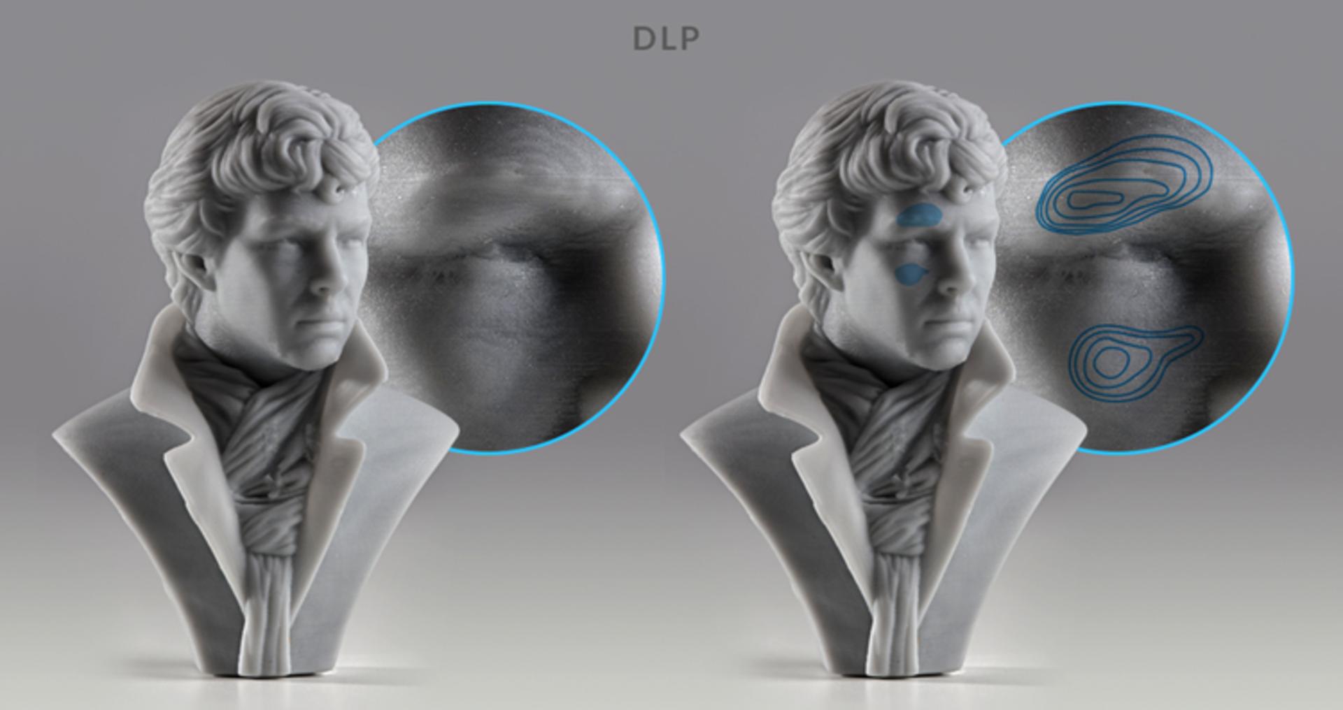 DLP and SLA